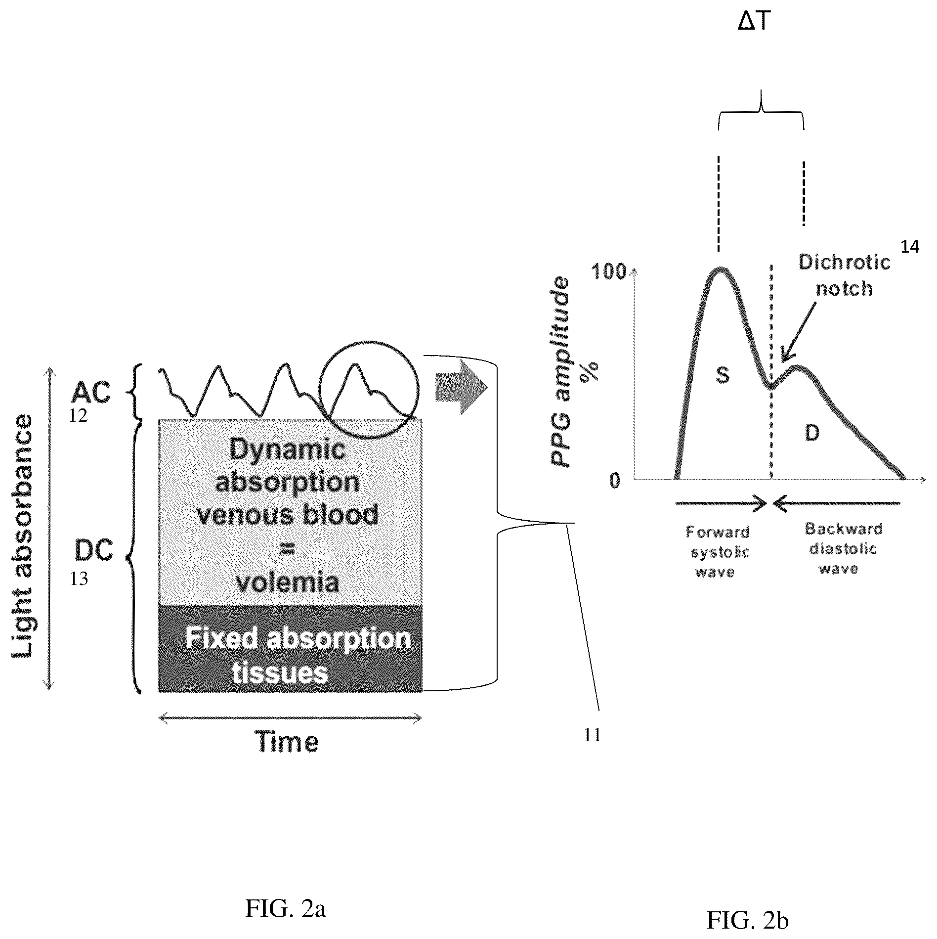 Patent US12599309 Figure 2 – Method and device for determining volemic status and vascular tone