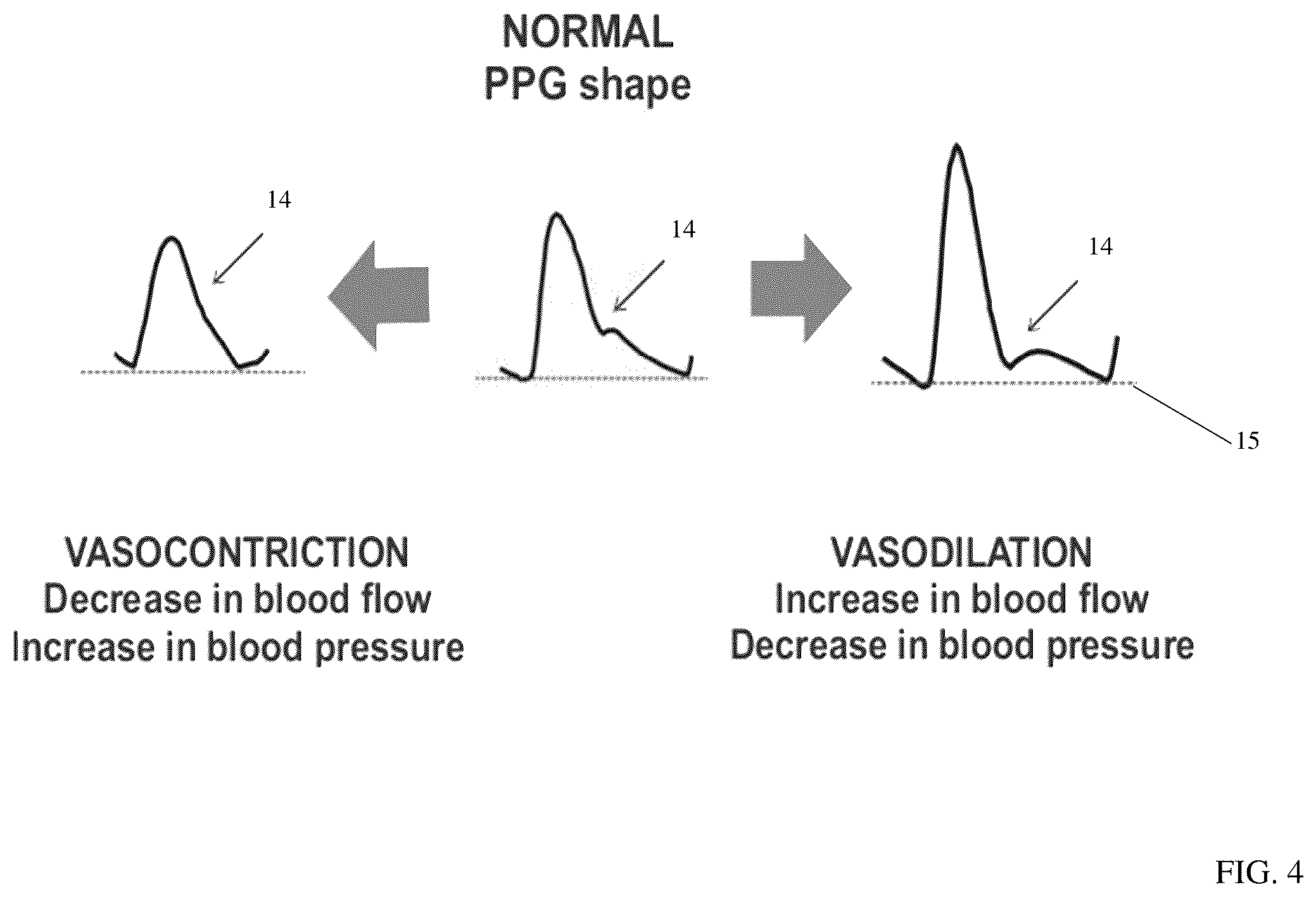 Patent US12599309 Figure 4 – Method and device for determining volemic status and vascular tone