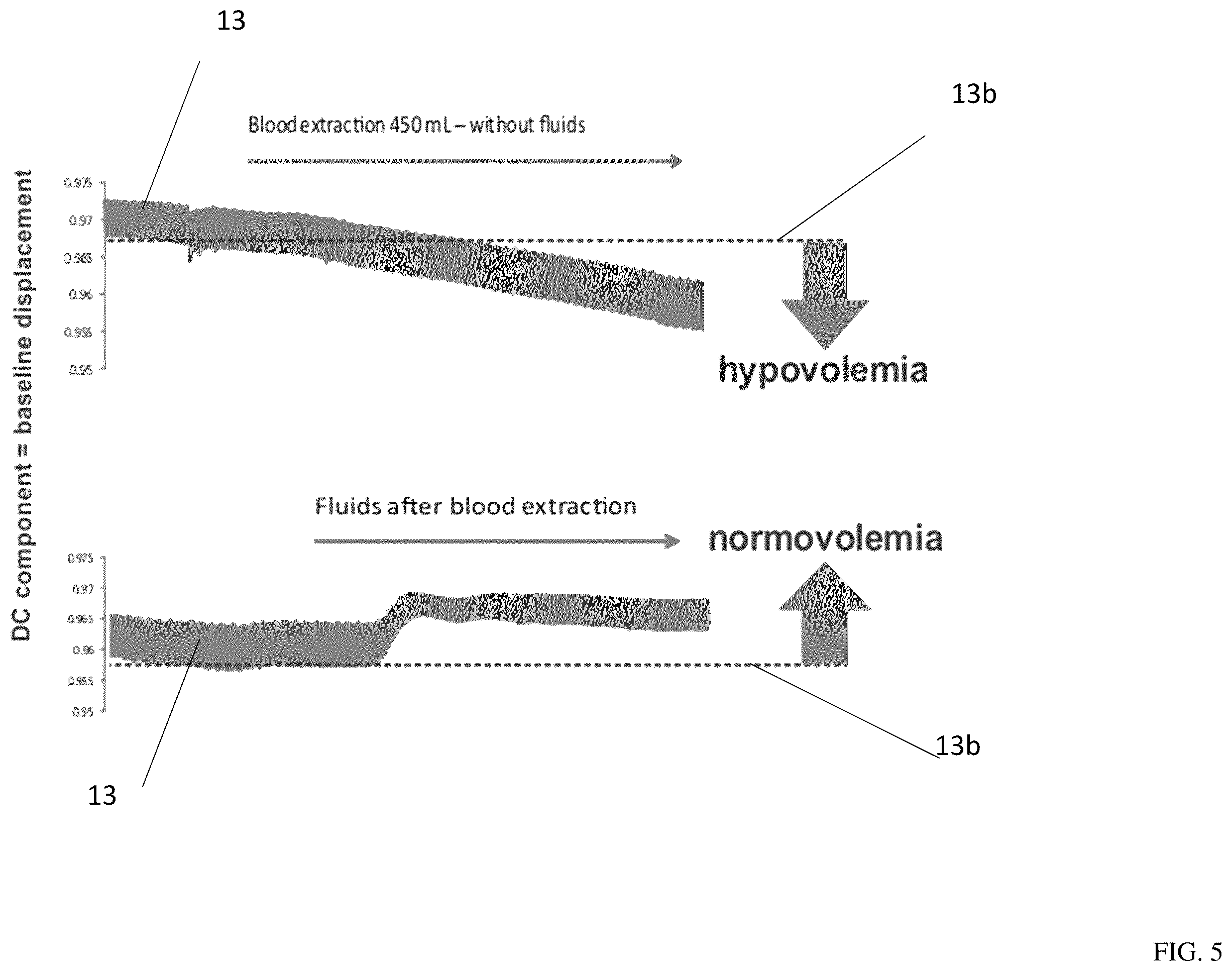 Patent US12599309 Figure 5 – Method and device for determining volemic status and vascular tone