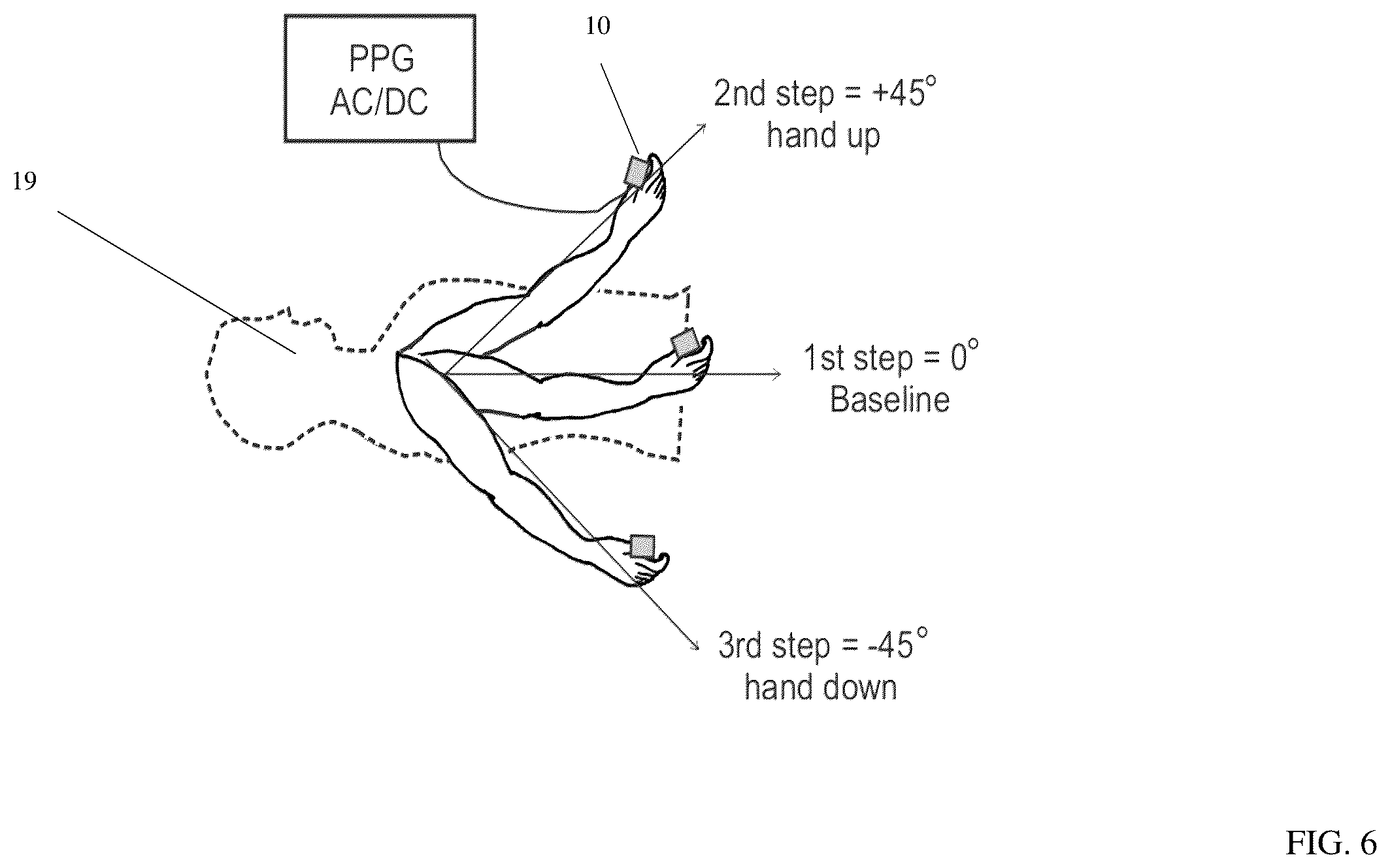 Patent US12599309 Figure 6 – Method and device for determining volemic status and vascular tone