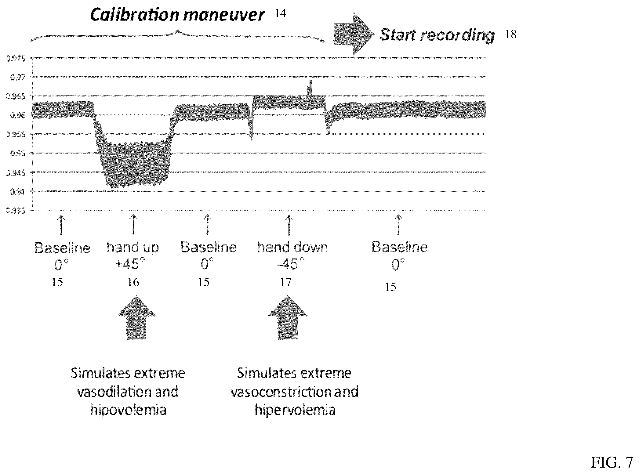 Patent US12599309 Figure 7 – Method and device for determining volemic status and vascular tone