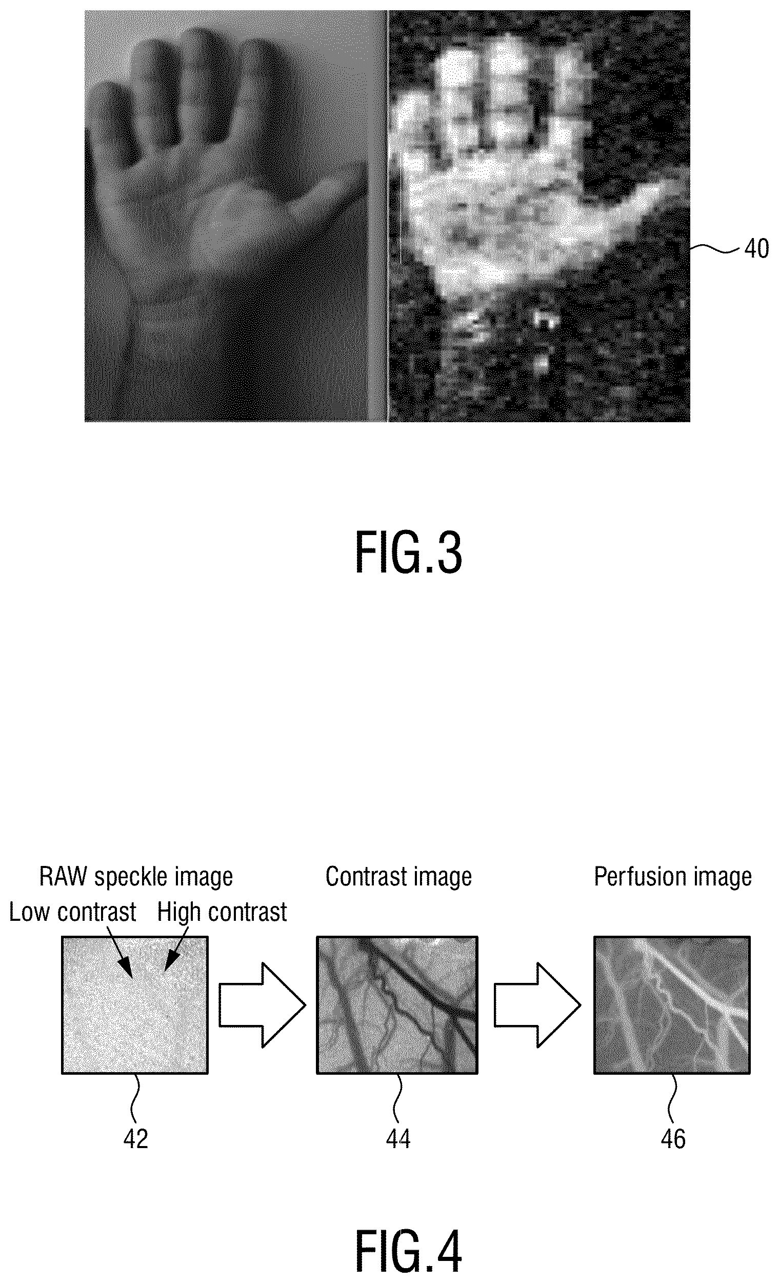 Patent US12599310 Figure 2 – Device, method and systems for providing imaging of one or more aspects of blood perfusion