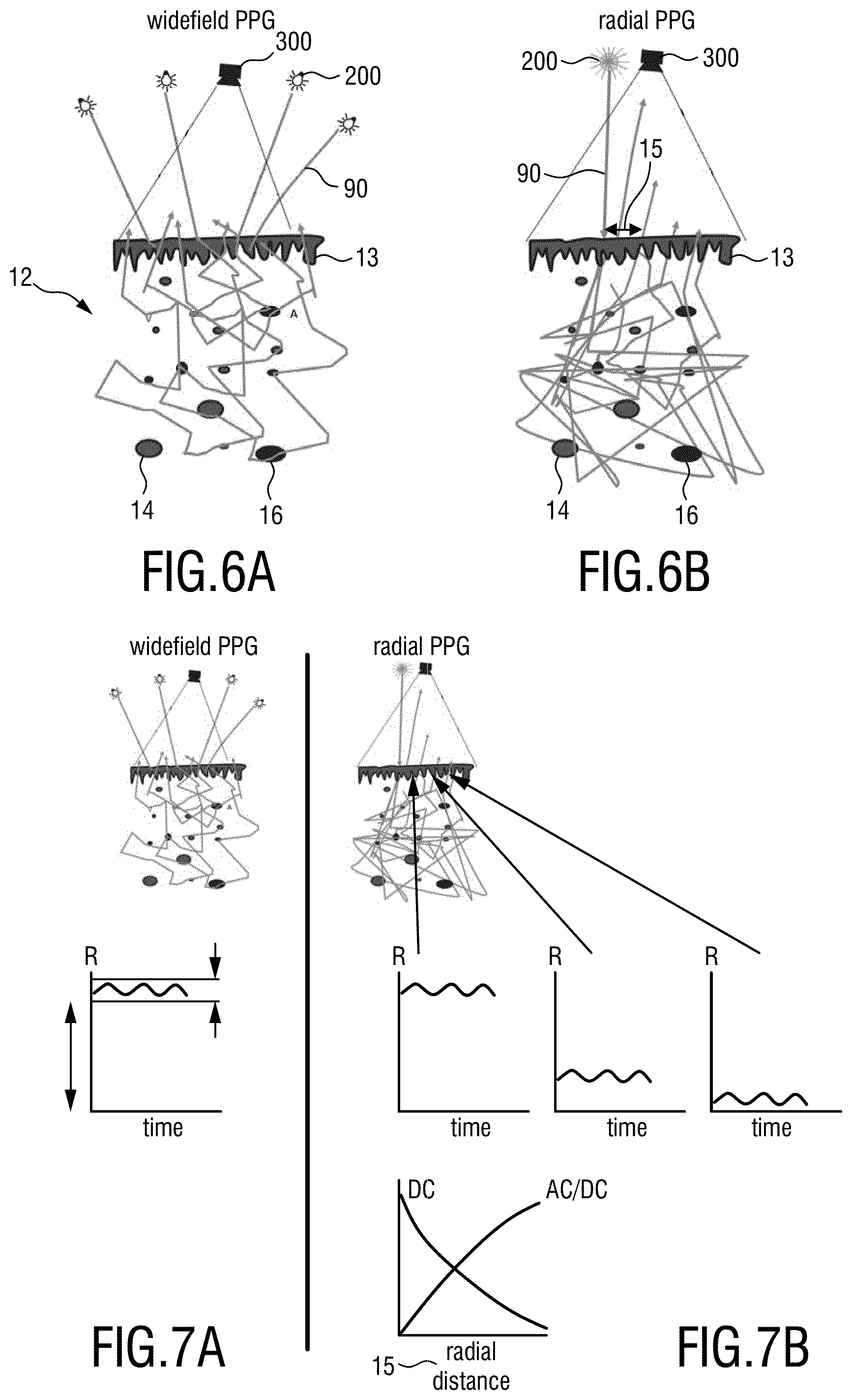 Patent US12599310 Figure 4 – Device, method and systems for providing imaging of one or more aspects of blood perfusion