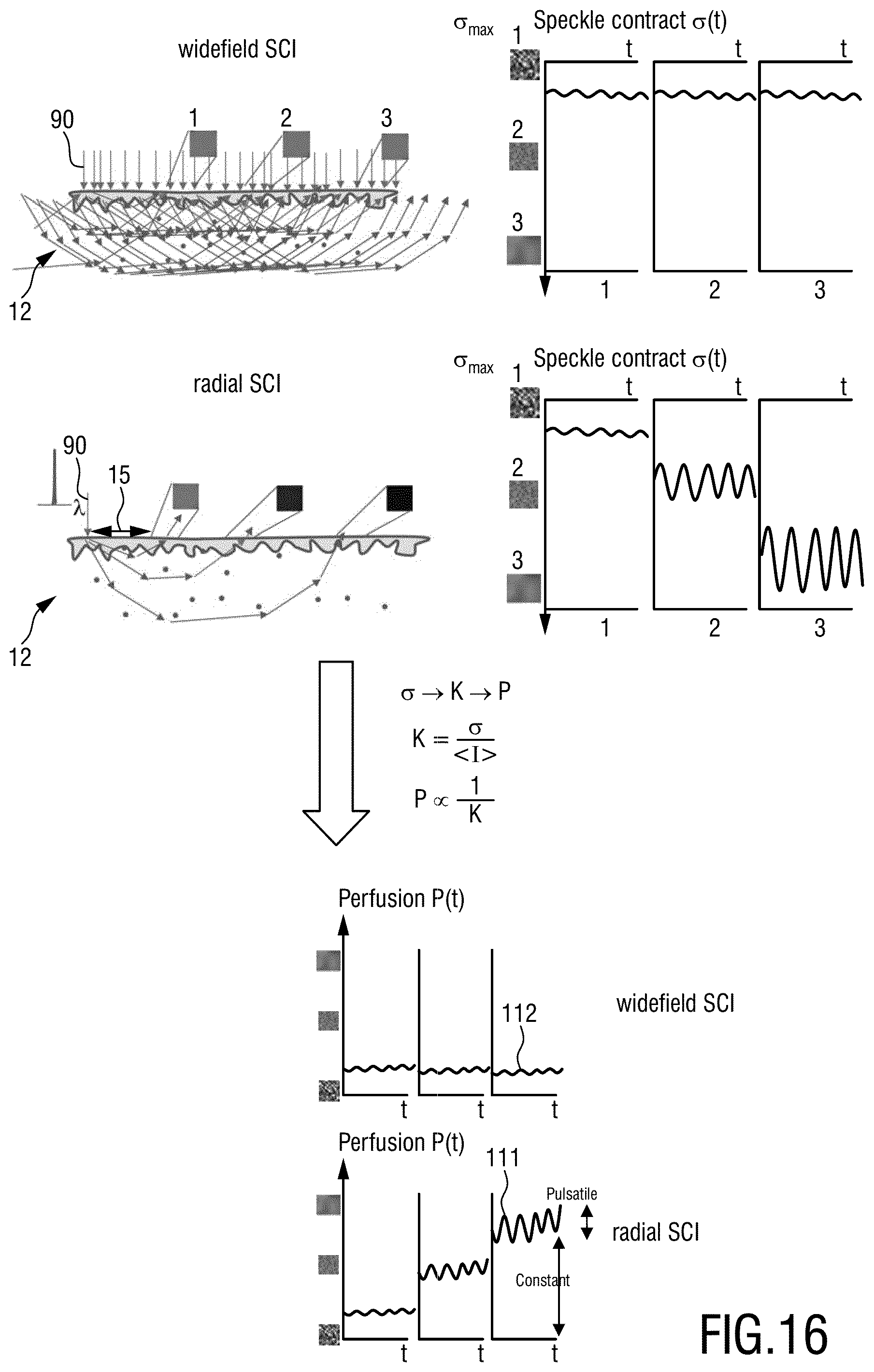 Patent US12599310 Figure 13 – Device, method and systems for providing imaging of one or more aspects of blood perfusion