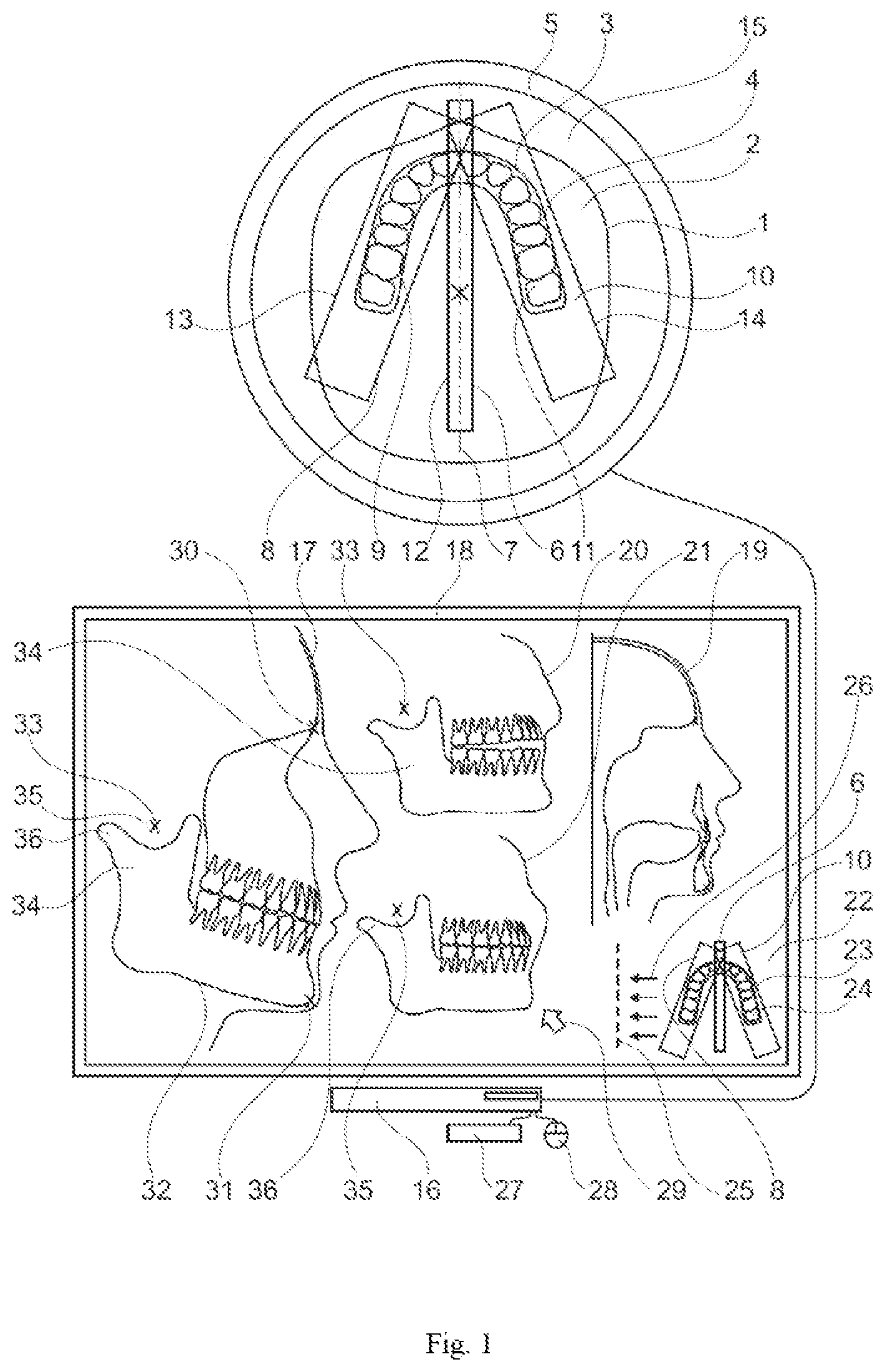 Patent US12599312 Figure 1 – Method for acquiring a dental object