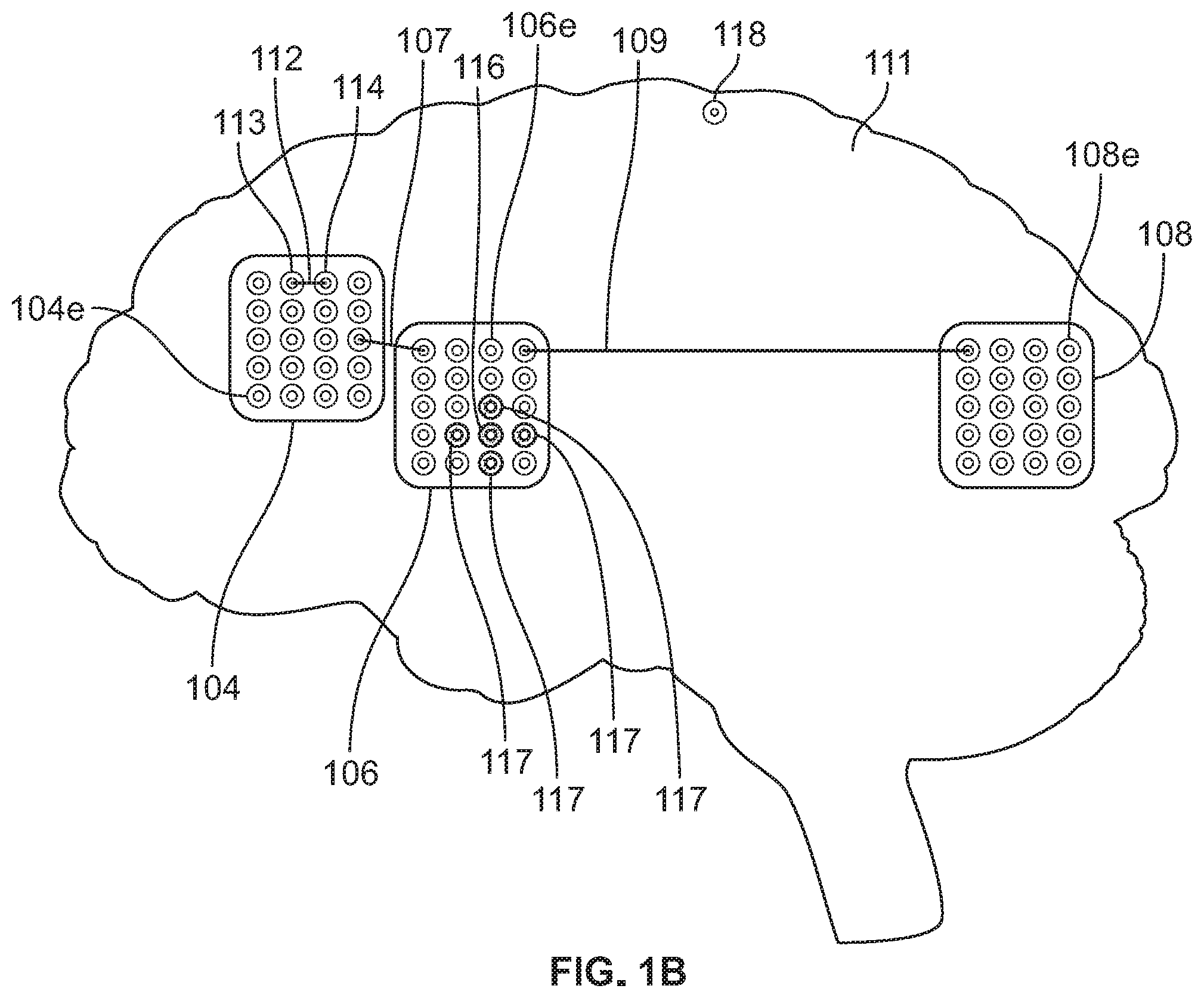 Patent US12599314 Figure 2 – Method and system for electrode verification