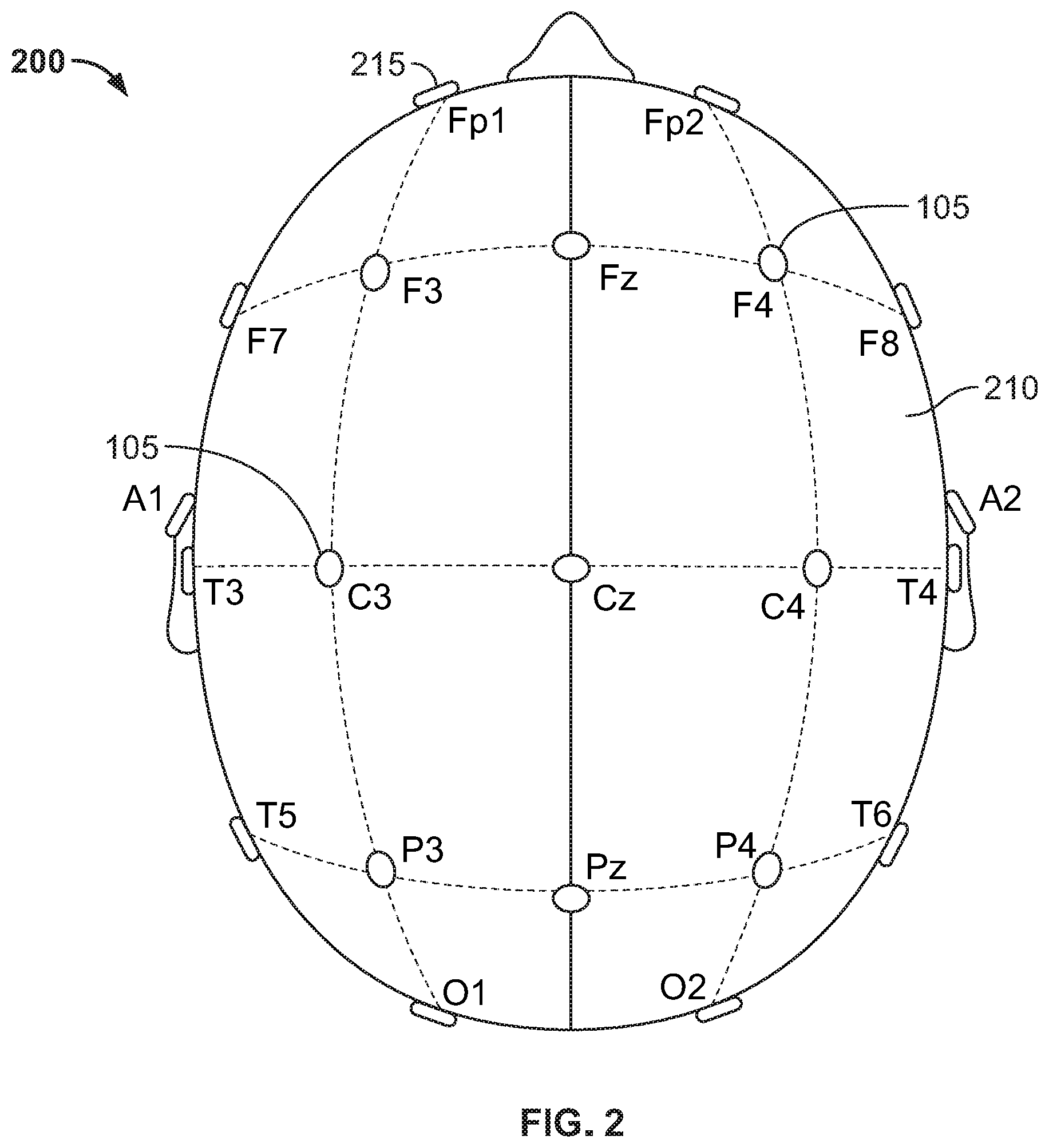 Patent US12599314 Figure 4 – Method and system for electrode verification