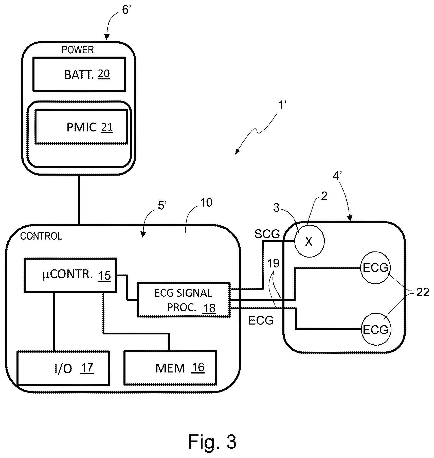 Patent US12599315 Figure 2 – Wearable and portable system and method for measuring cardiac parameters for detecting cardiopathies