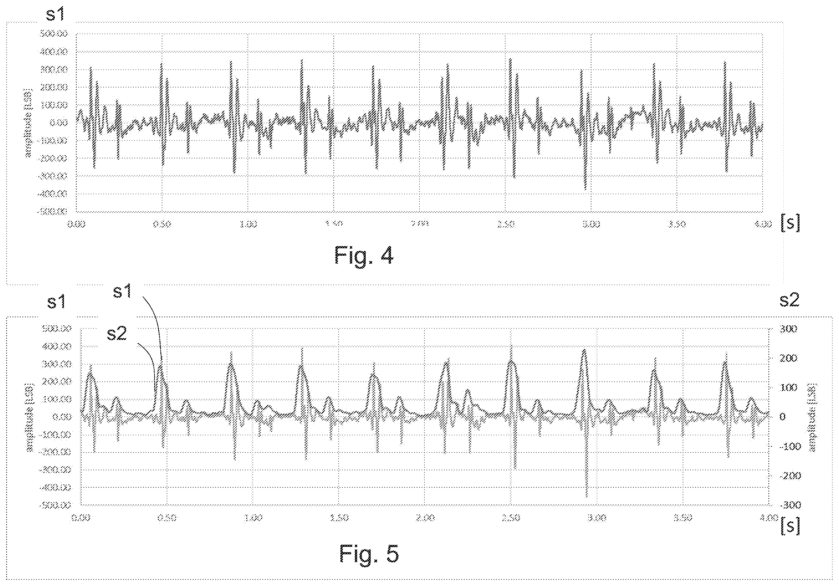 Patent US12599315 Figure 3 – Wearable and portable system and method for measuring cardiac parameters for detecting cardiopathies