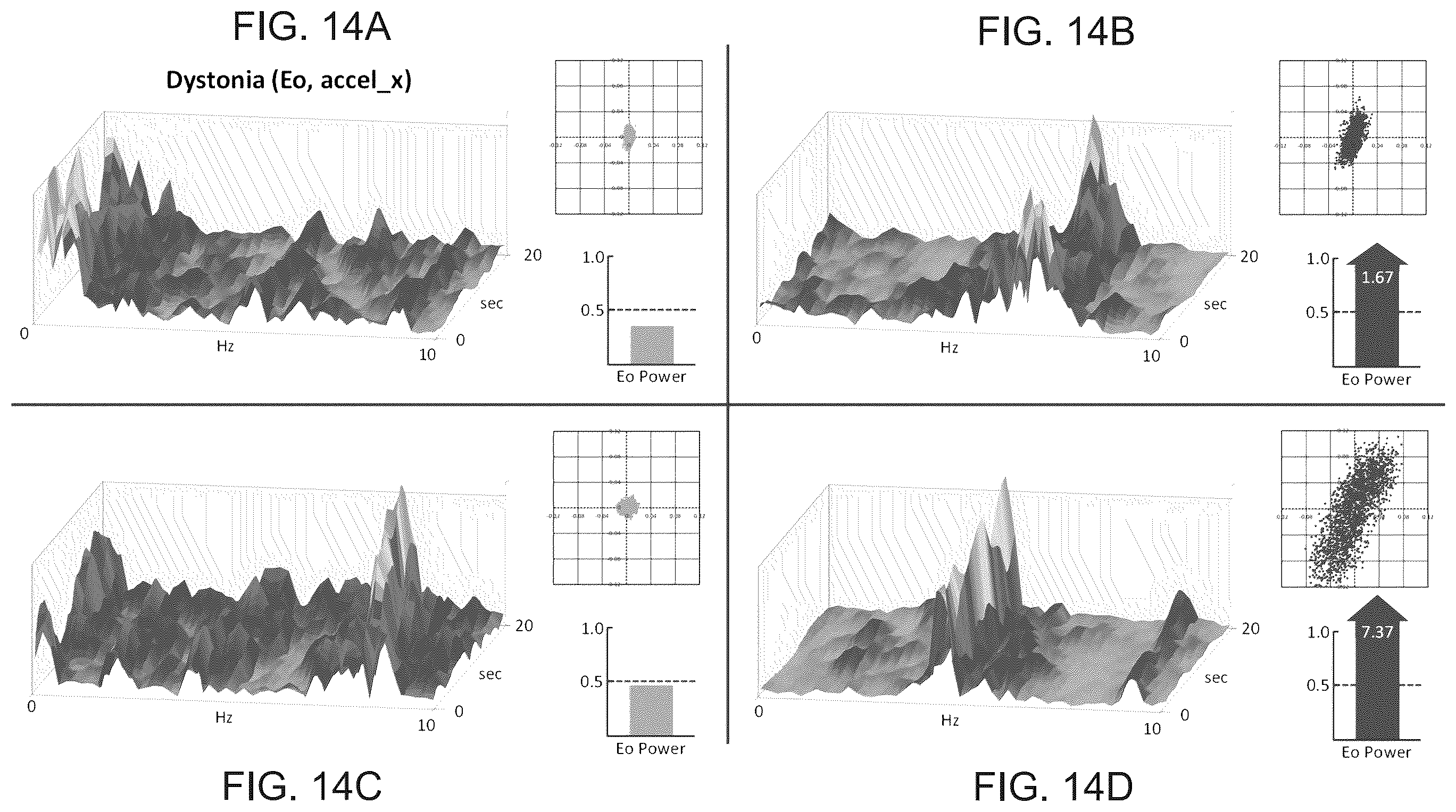 Patent US12599316 Figure 15 – Systems and methods for detecting and treating neurophysiological impairment
