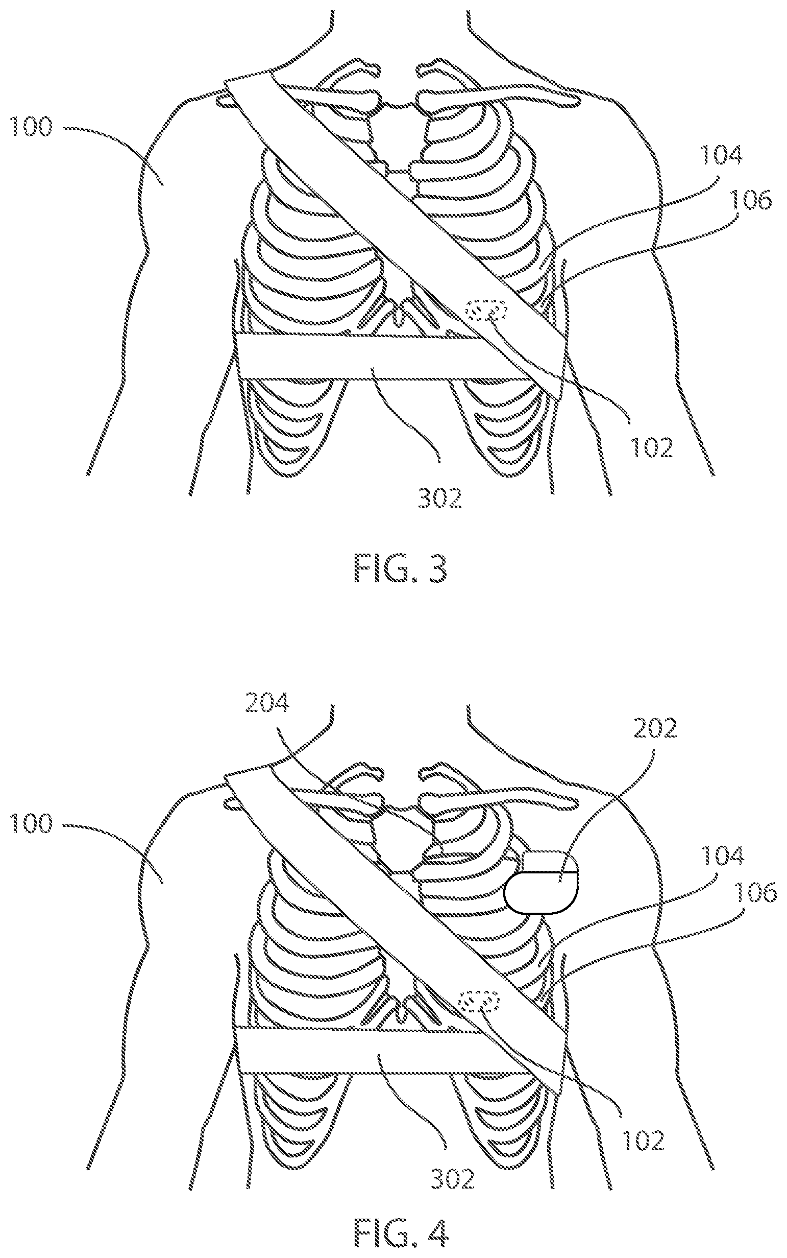 Patent US12599321 Figure 2 – Devices and methods for assessing pulmonary status using optical oxygenation sensing