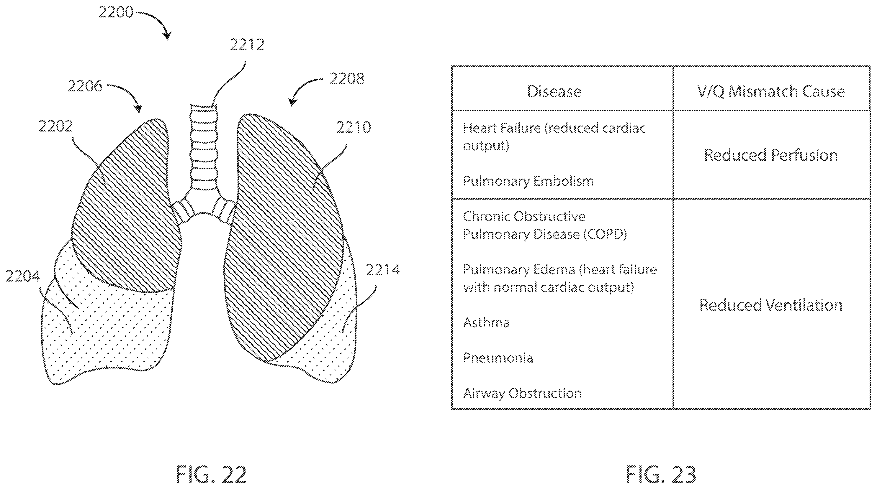 Patent US12599321 Figure 15 – Devices and methods for assessing pulmonary status using optical oxygenation sensing