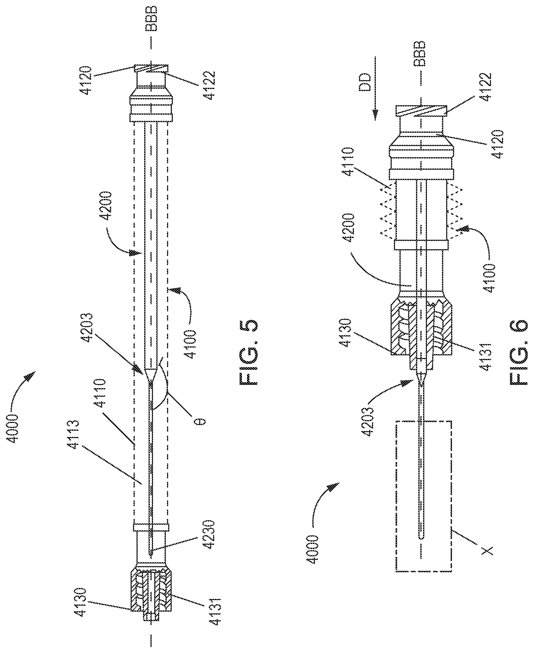 Patent US12599324 Figure 3 – Systems and methods for phlebotomy through a peripheral IV catheter