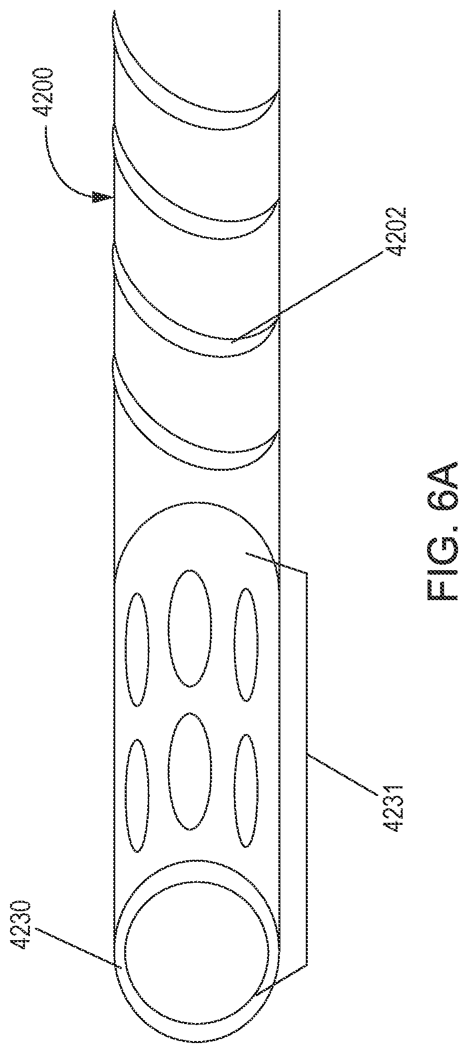 Patent US12599324 Figure 4 – Systems and methods for phlebotomy through a peripheral IV catheter