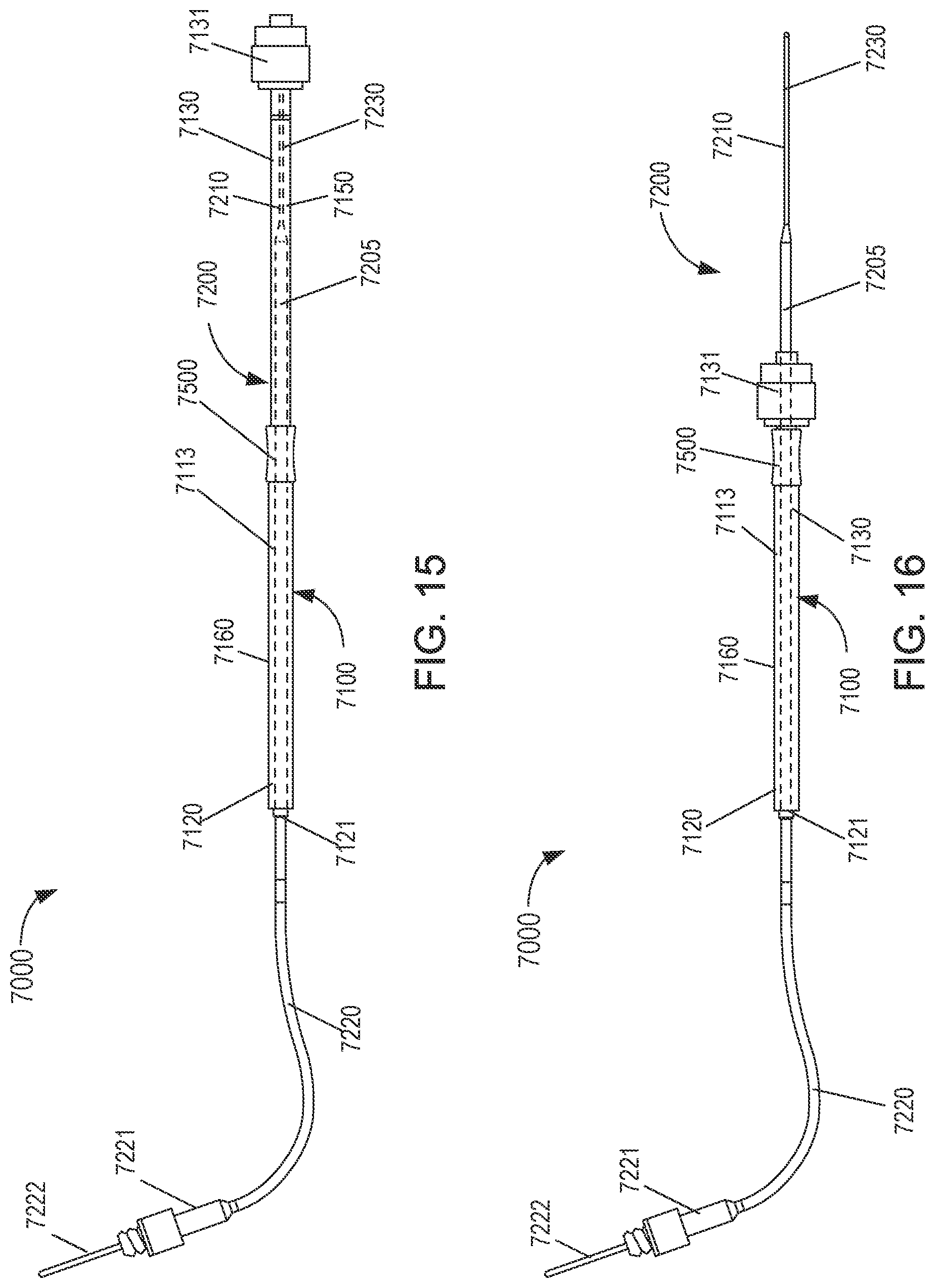 Patent US12599324 Figure 12 – Systems and methods for phlebotomy through a peripheral IV catheter