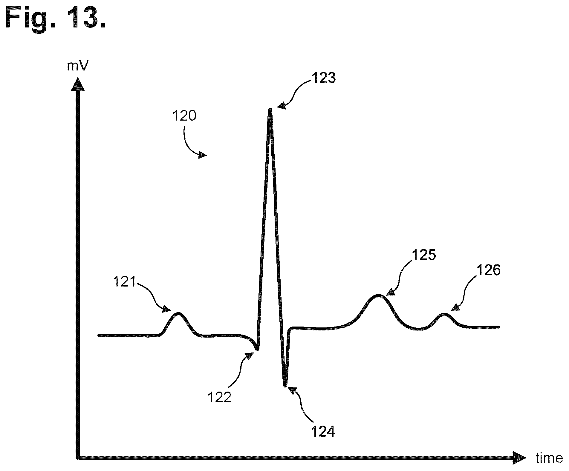 Patent US12599326 Figure 8 – Moisture-resistant electrocardiography monitor
