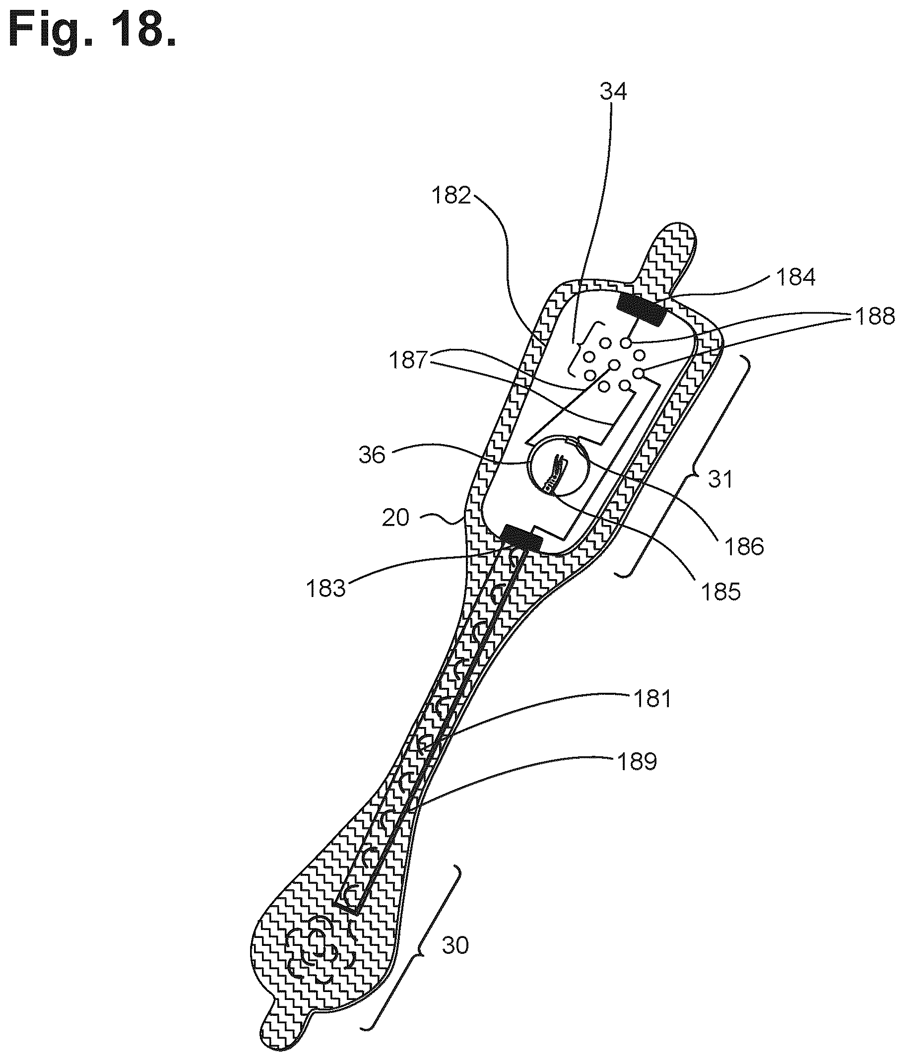 Patent US12599326 Figure 14 – Moisture-resistant electrocardiography monitor