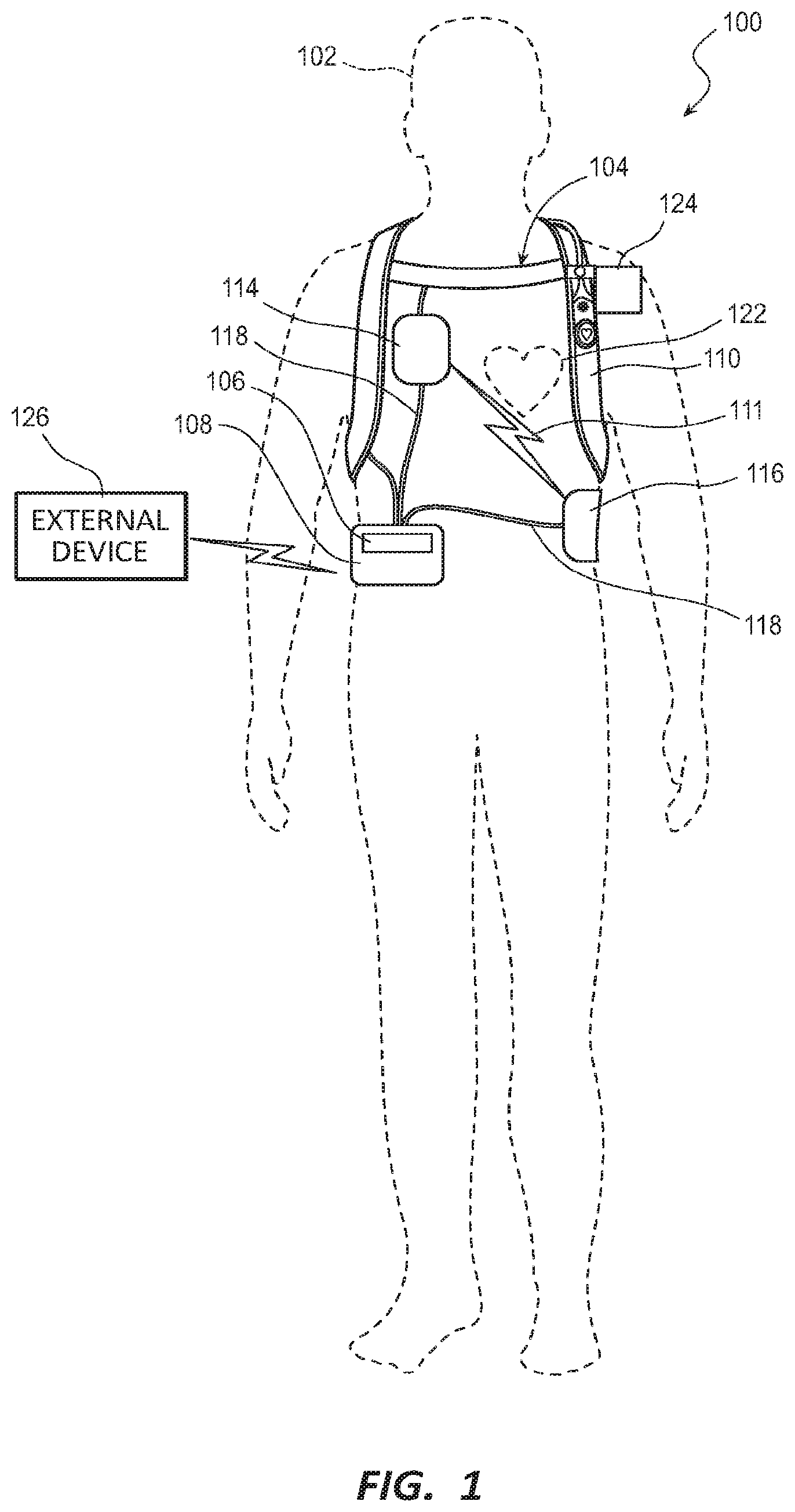 Patent US12599328 Figure 1 – Method to detect noise in a wearable cardioverter defibrillator