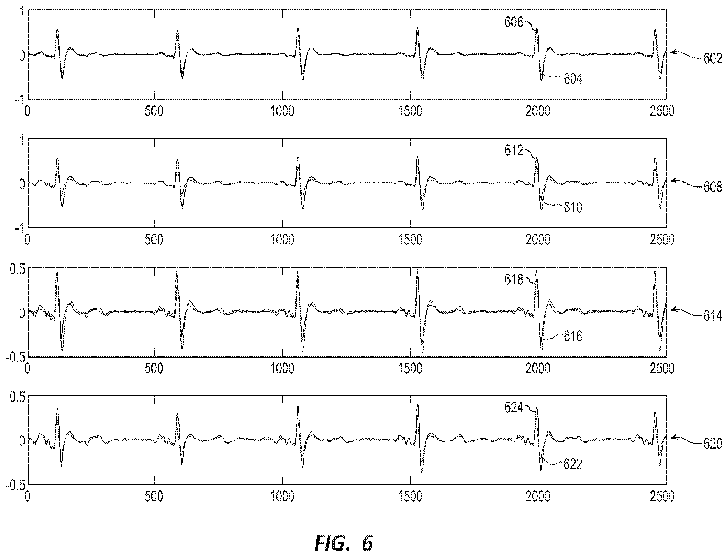 Patent US12599328 Figure 6 – Method to detect noise in a wearable cardioverter defibrillator