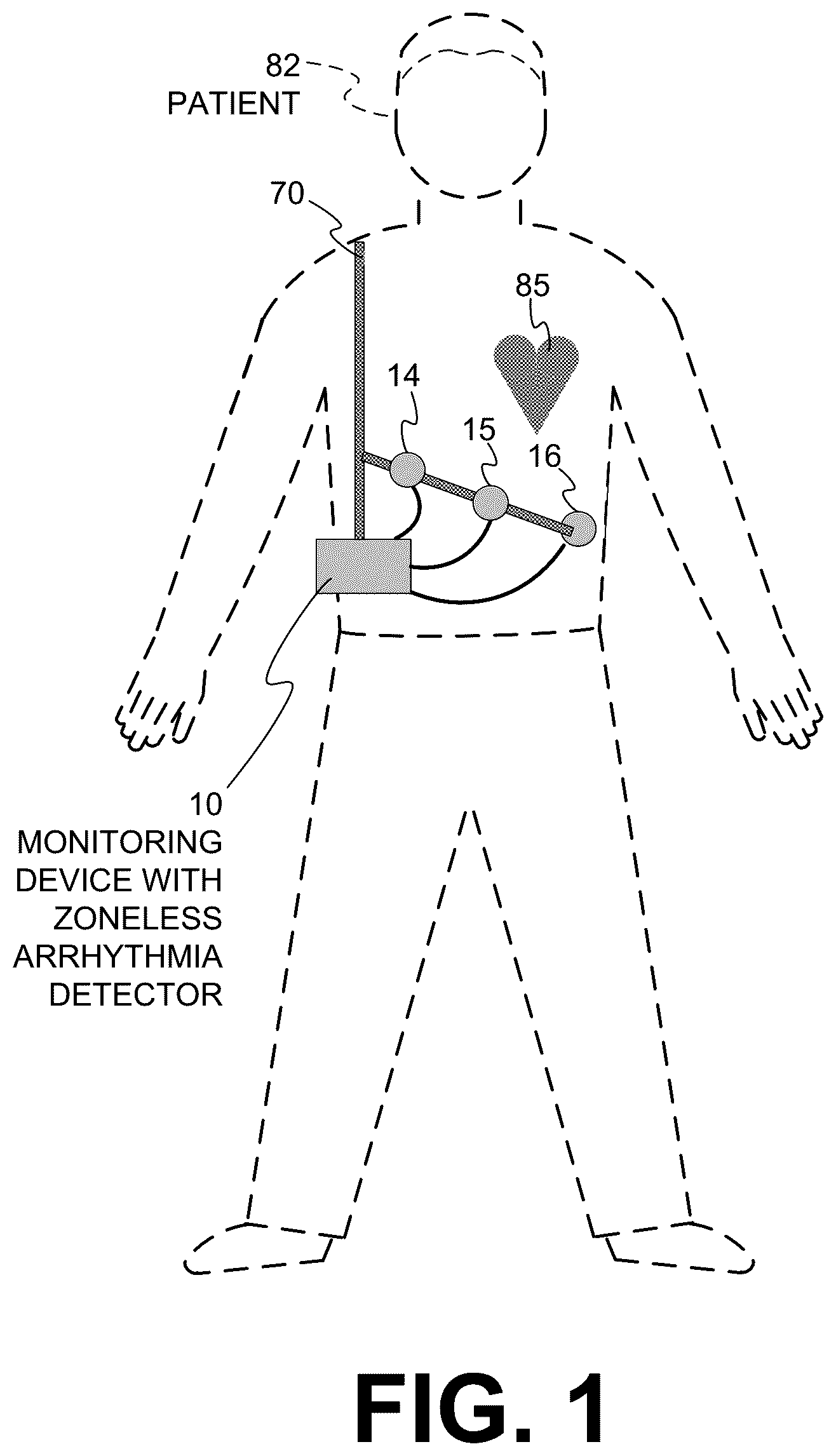 Patent US12599330 Figure 1 – Wearable medical device with zoneless arrhythmia detection