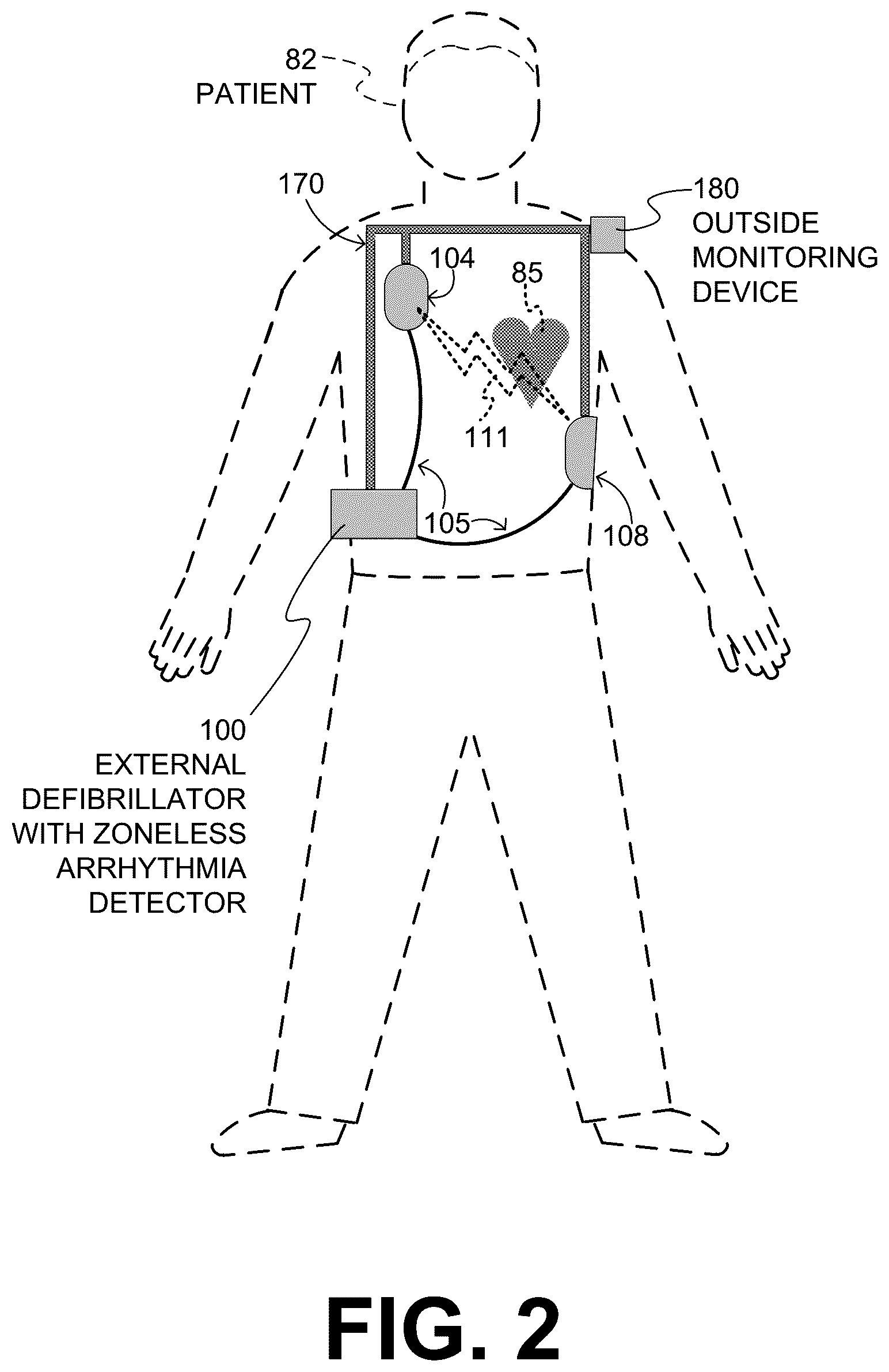 Patent US12599330 Figure 2 – Wearable medical device with zoneless arrhythmia detection