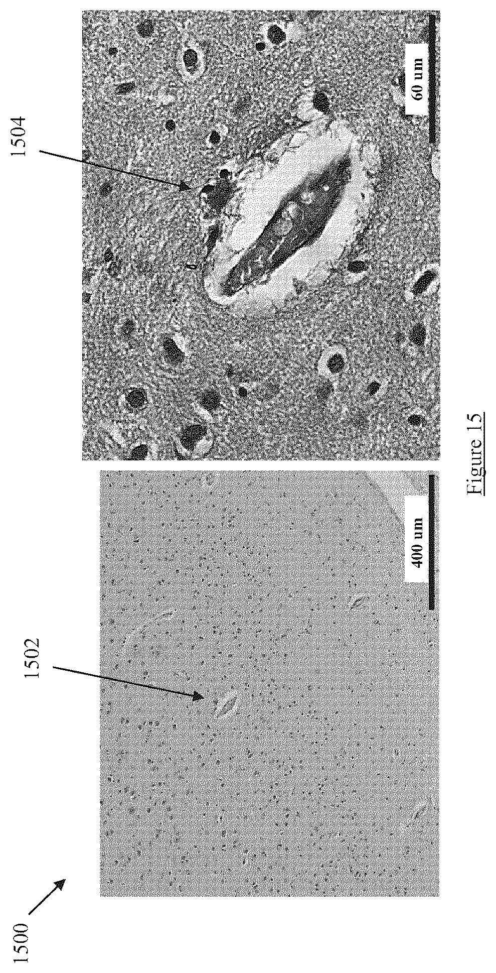 Patent US12599331 Figure 15 – Hyperspectral image-guided ocular imager for Alzheimer's Disease pathologies