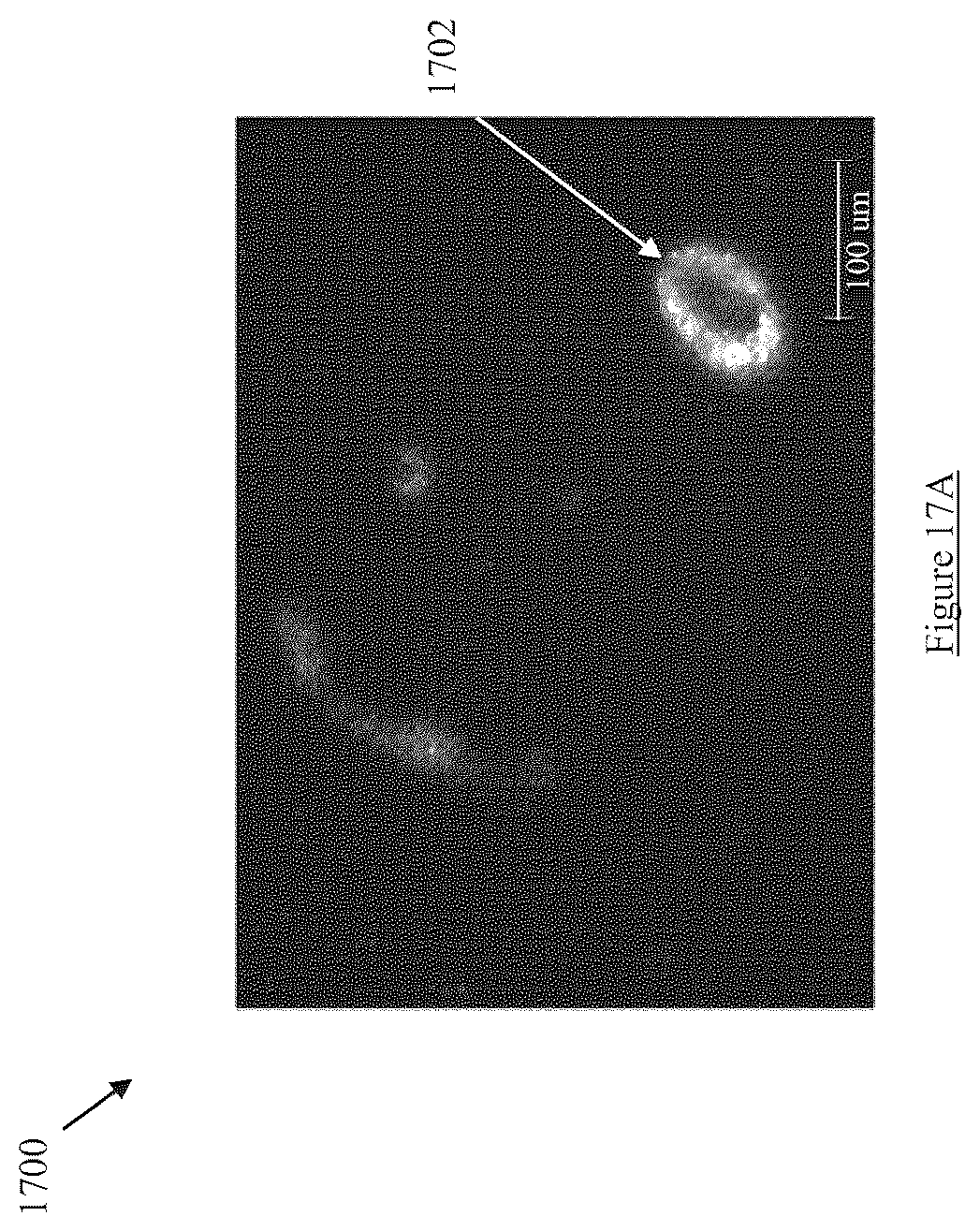 Patent US12599331 Figure 17 – Hyperspectral image-guided ocular imager for Alzheimer's Disease pathologies