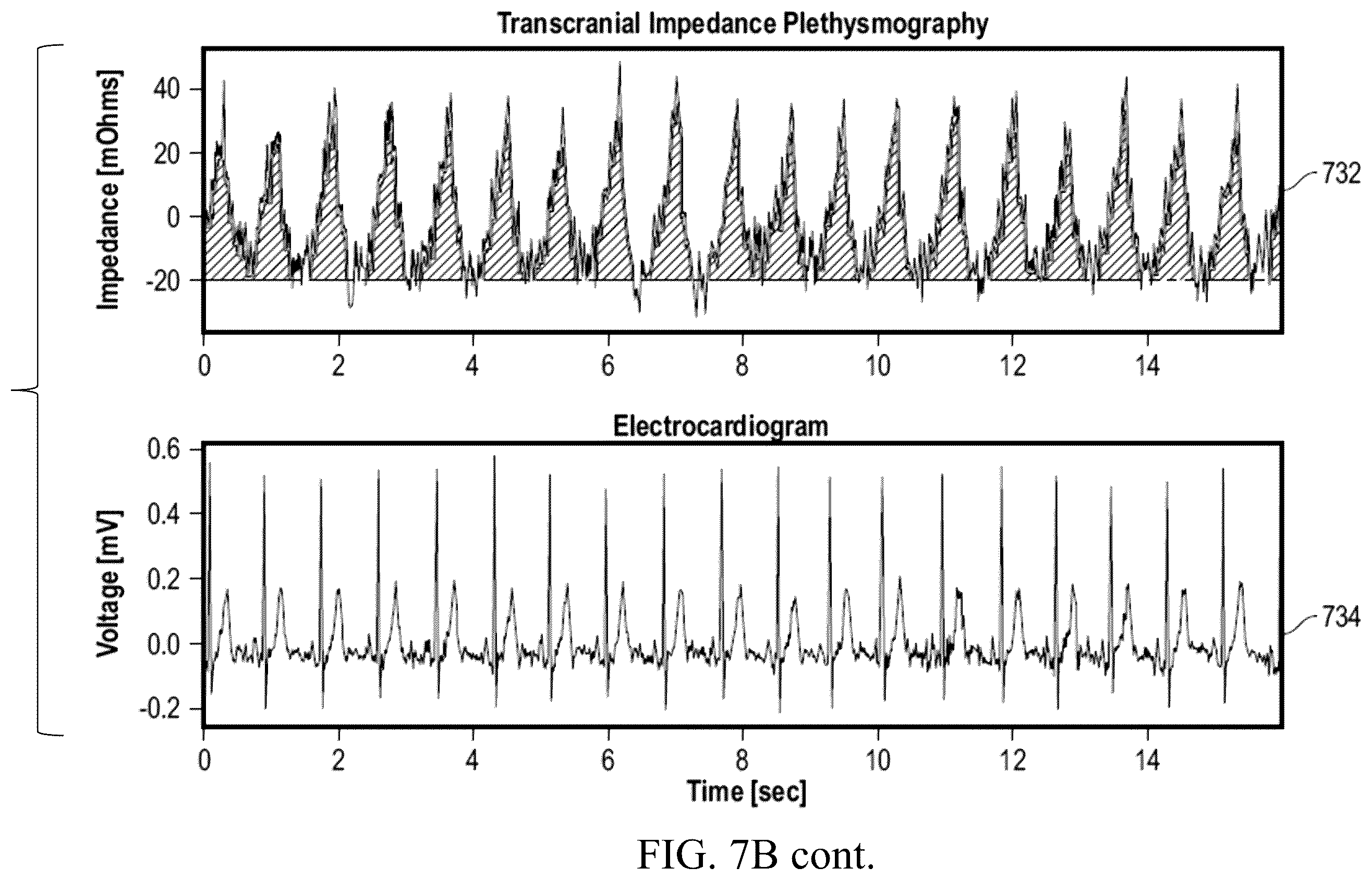 Patent US12599332 Figure 16 – Non-invasive assessment of glymphatic flow and neurodegeneration from a wearable device