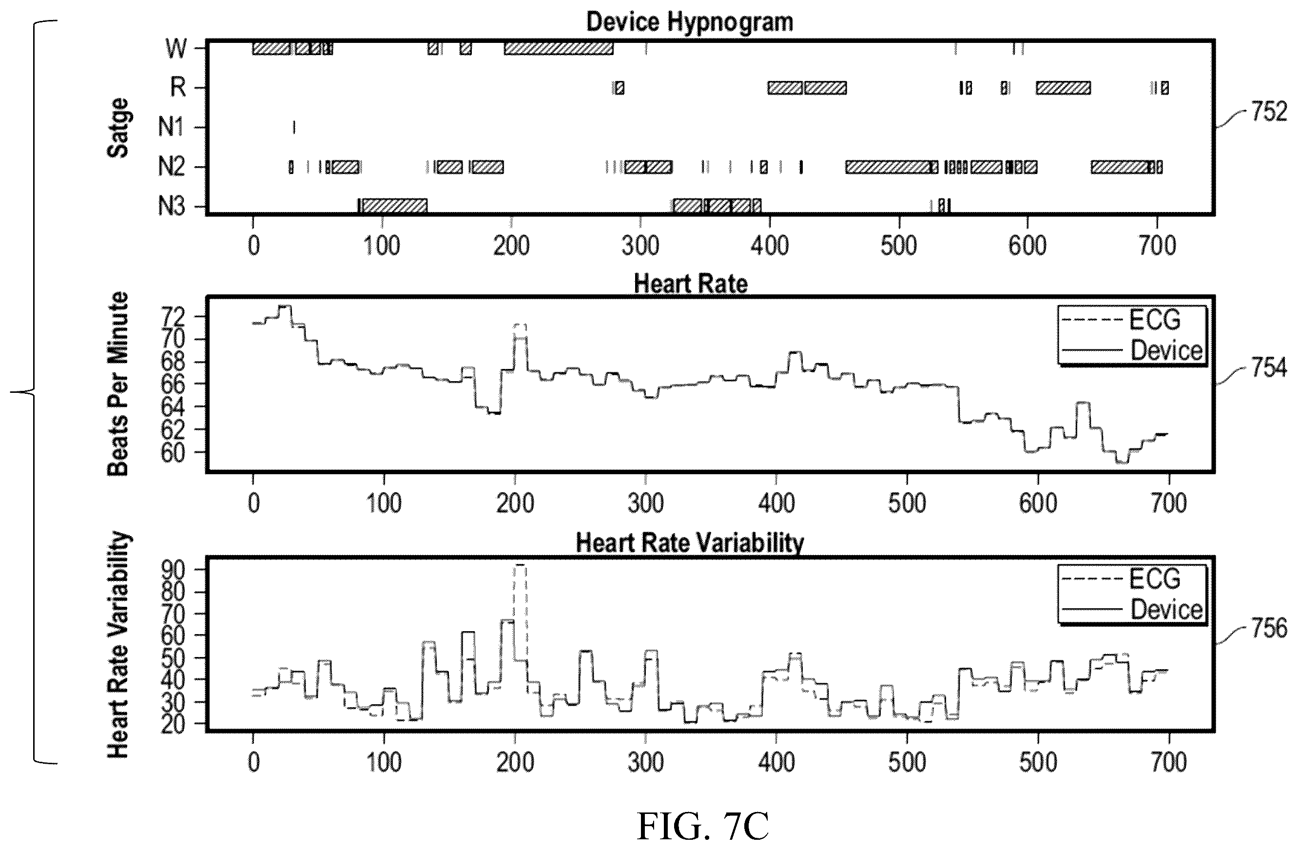 Patent US12599332 Figure 17 – Non-invasive assessment of glymphatic flow and neurodegeneration from a wearable device