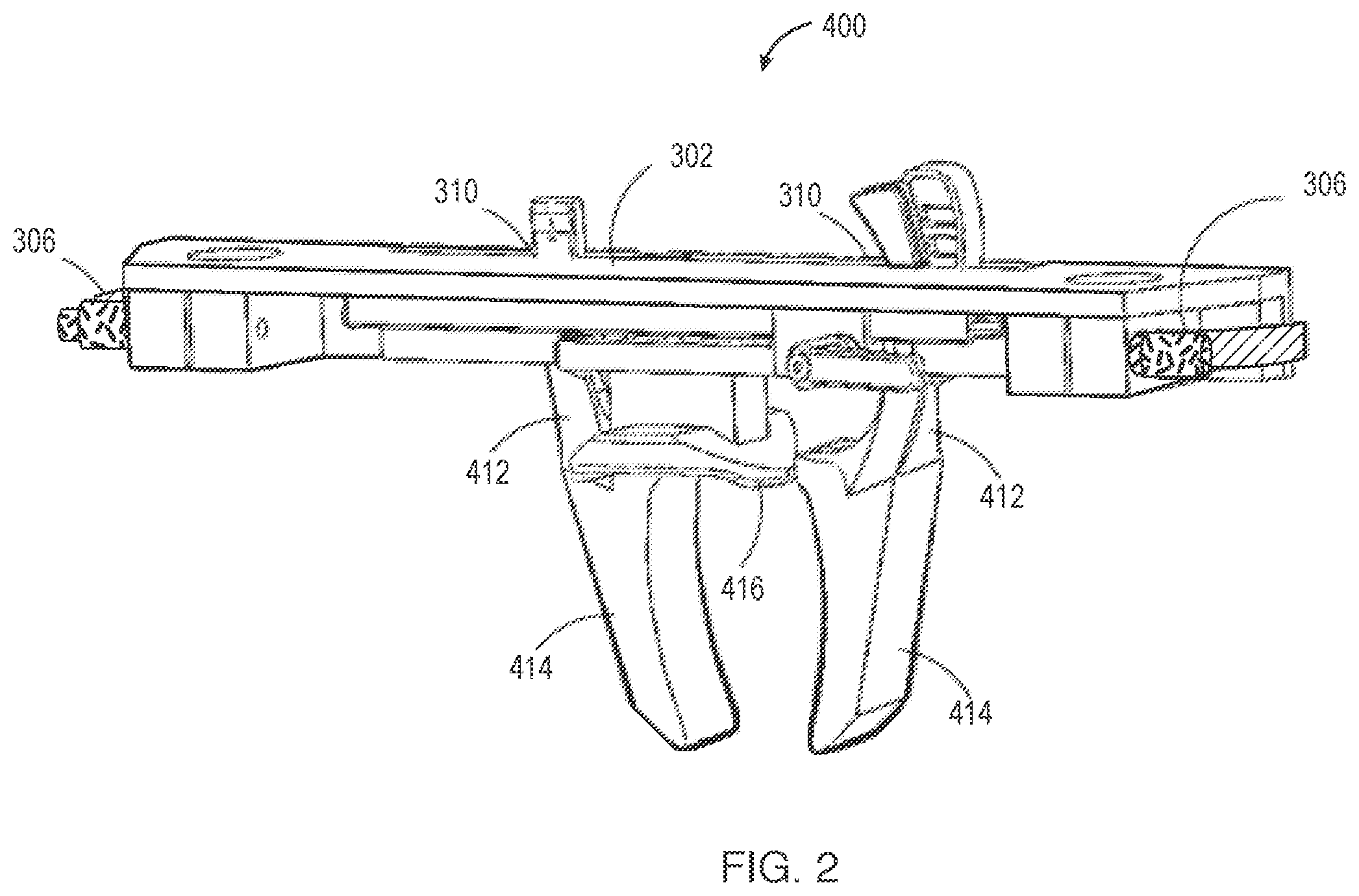 Patent US12599333 Figure 2 – Multi-axial joint laxity testing apparatus and method