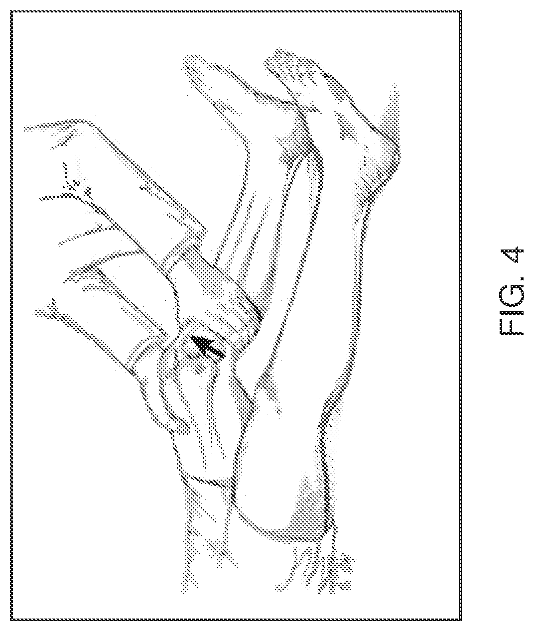 Patent US12599333 Figure 4 – Multi-axial joint laxity testing apparatus and method