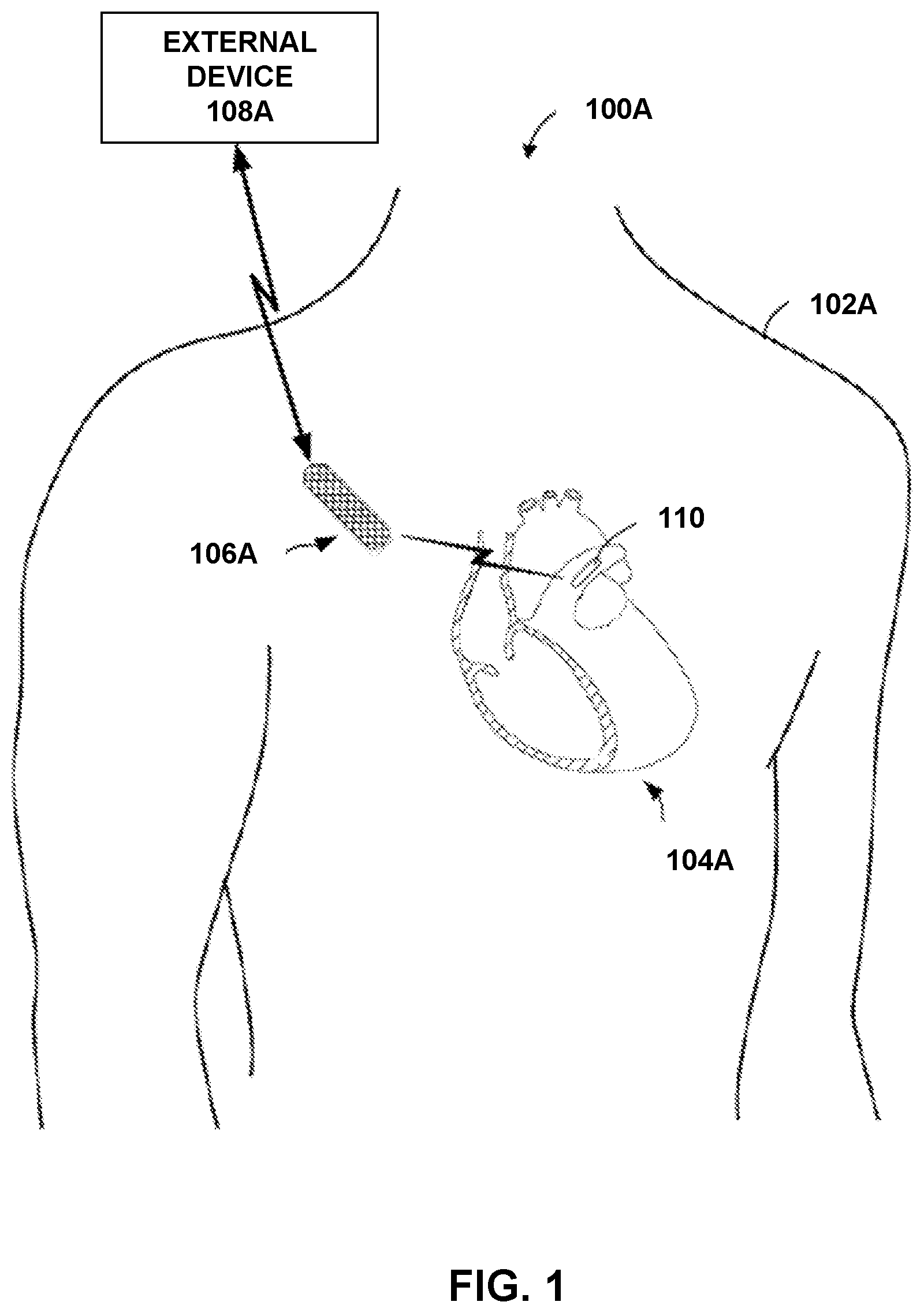 Patent US12599335 Figure 1 – Detection and monitoring of sleep apnea conditions