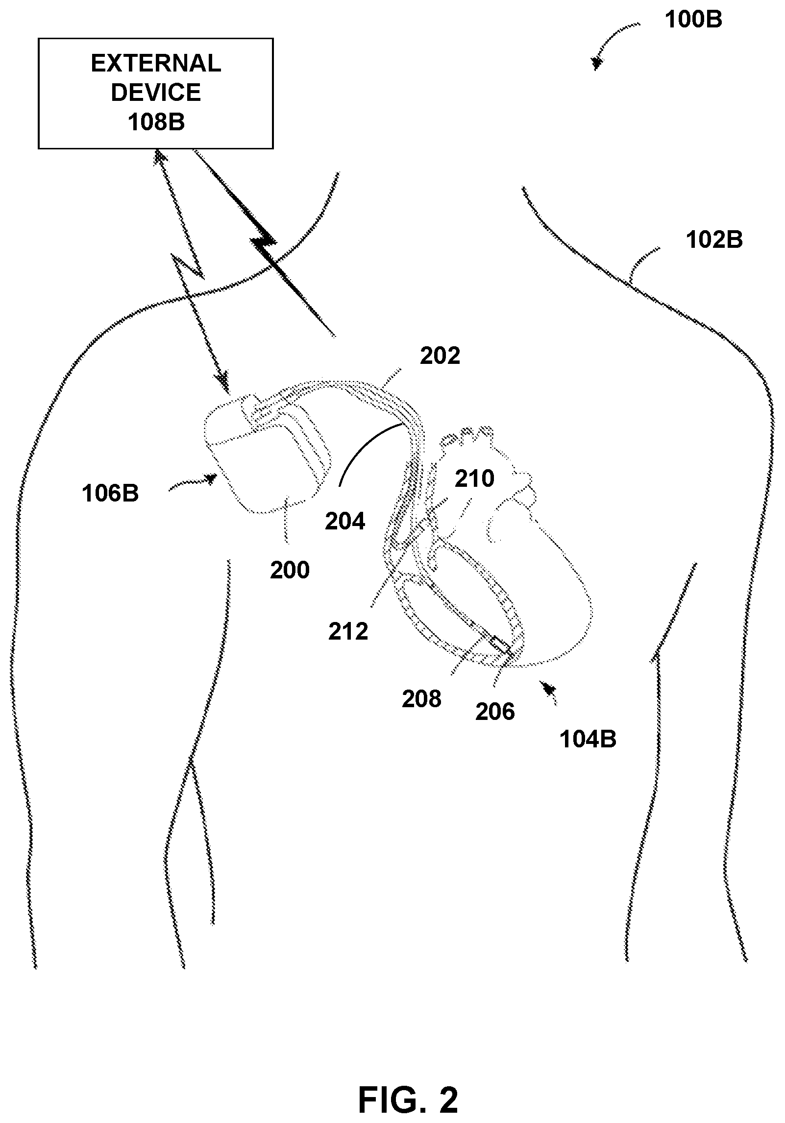 Patent US12599335 Figure 2 – Detection and monitoring of sleep apnea conditions