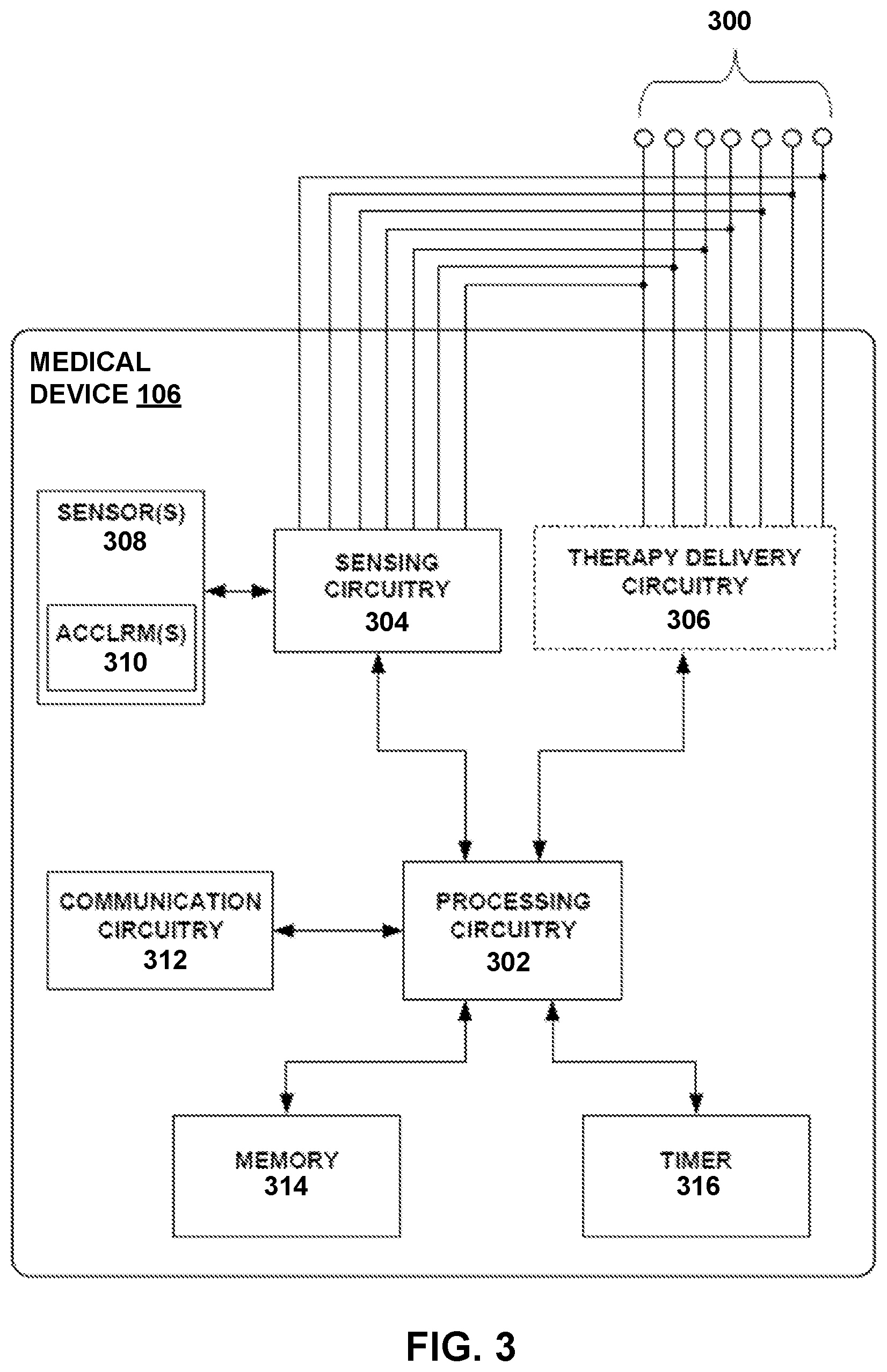 Patent US12599335 Figure 3 – Detection and monitoring of sleep apnea conditions