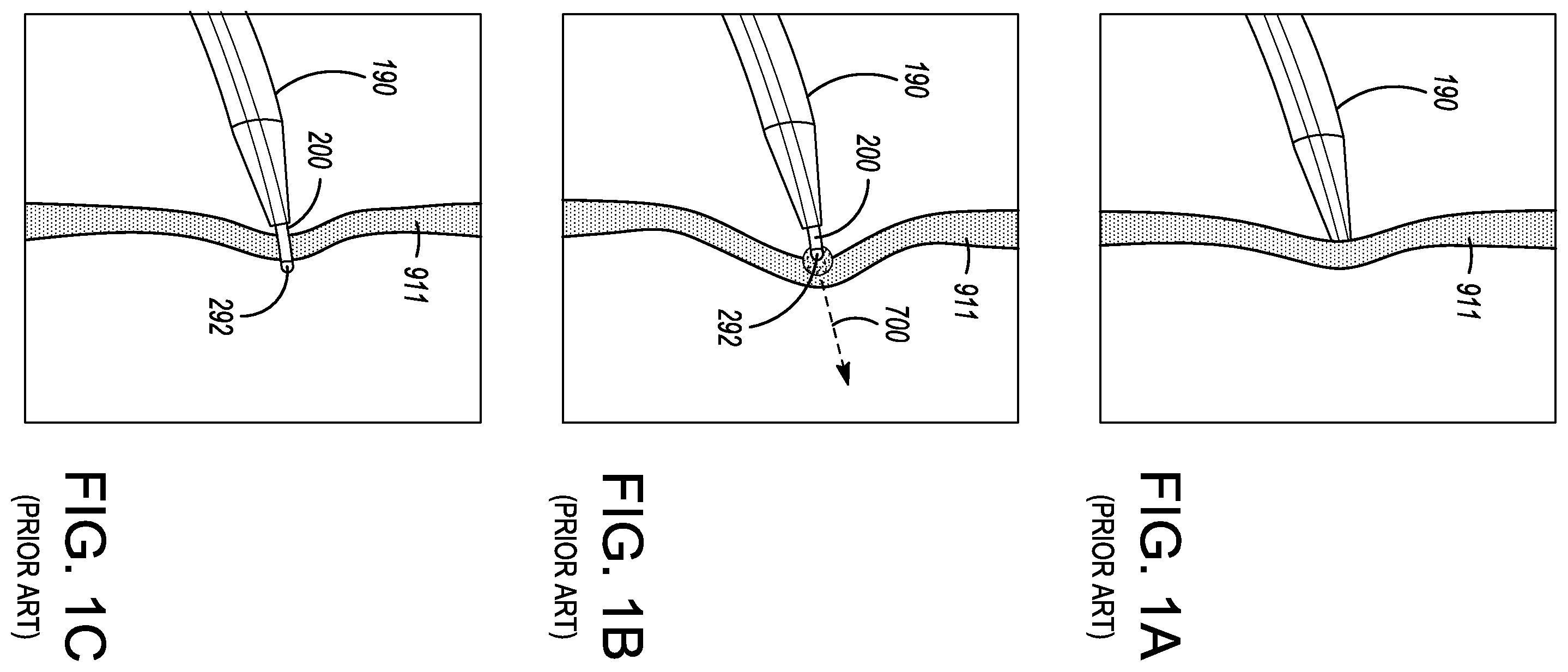 Patent US12599338 Figure 1 – Deflectable elongated guidewire assembly