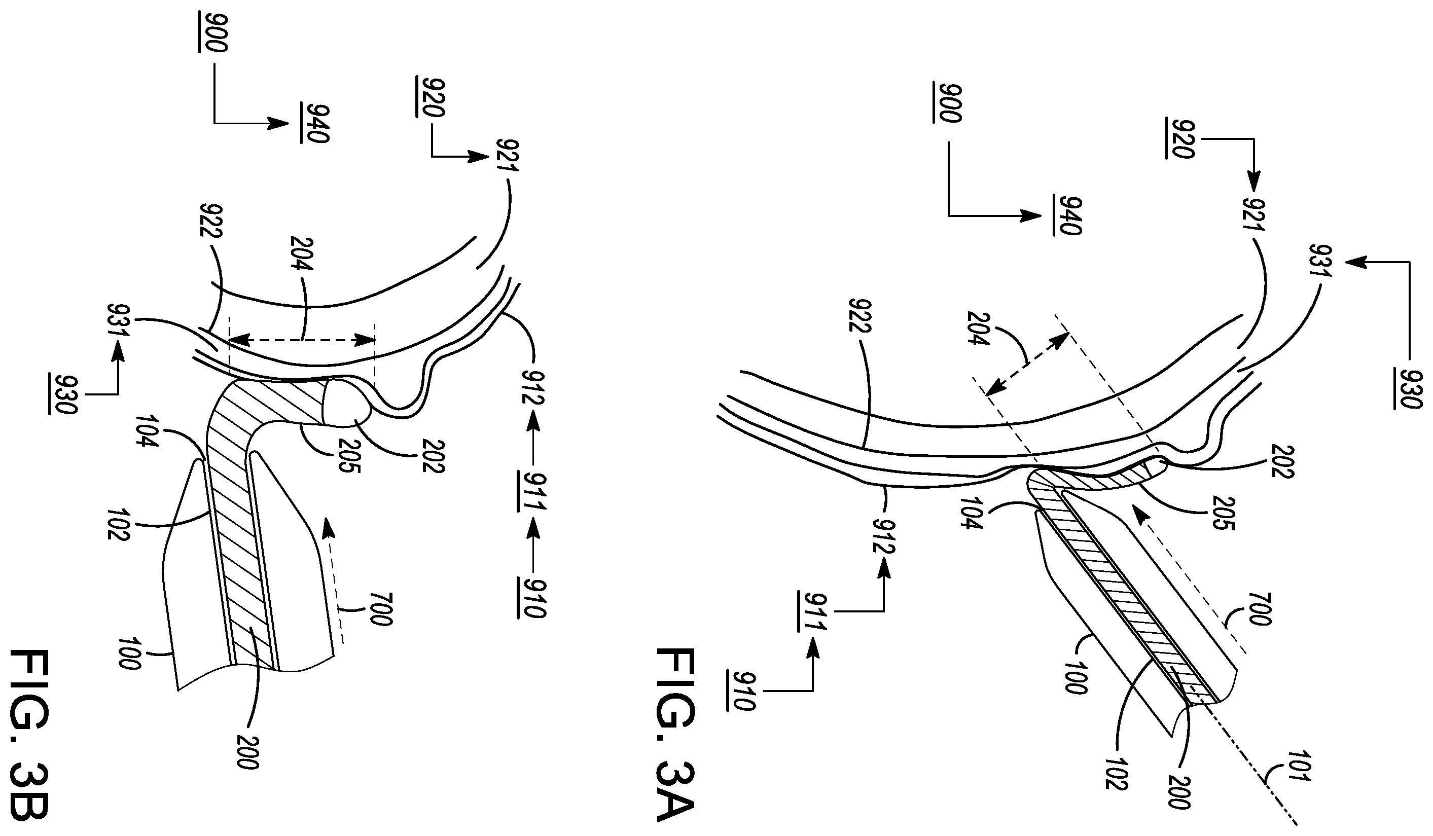 Patent US12599338 Figure 3 – Deflectable elongated guidewire assembly