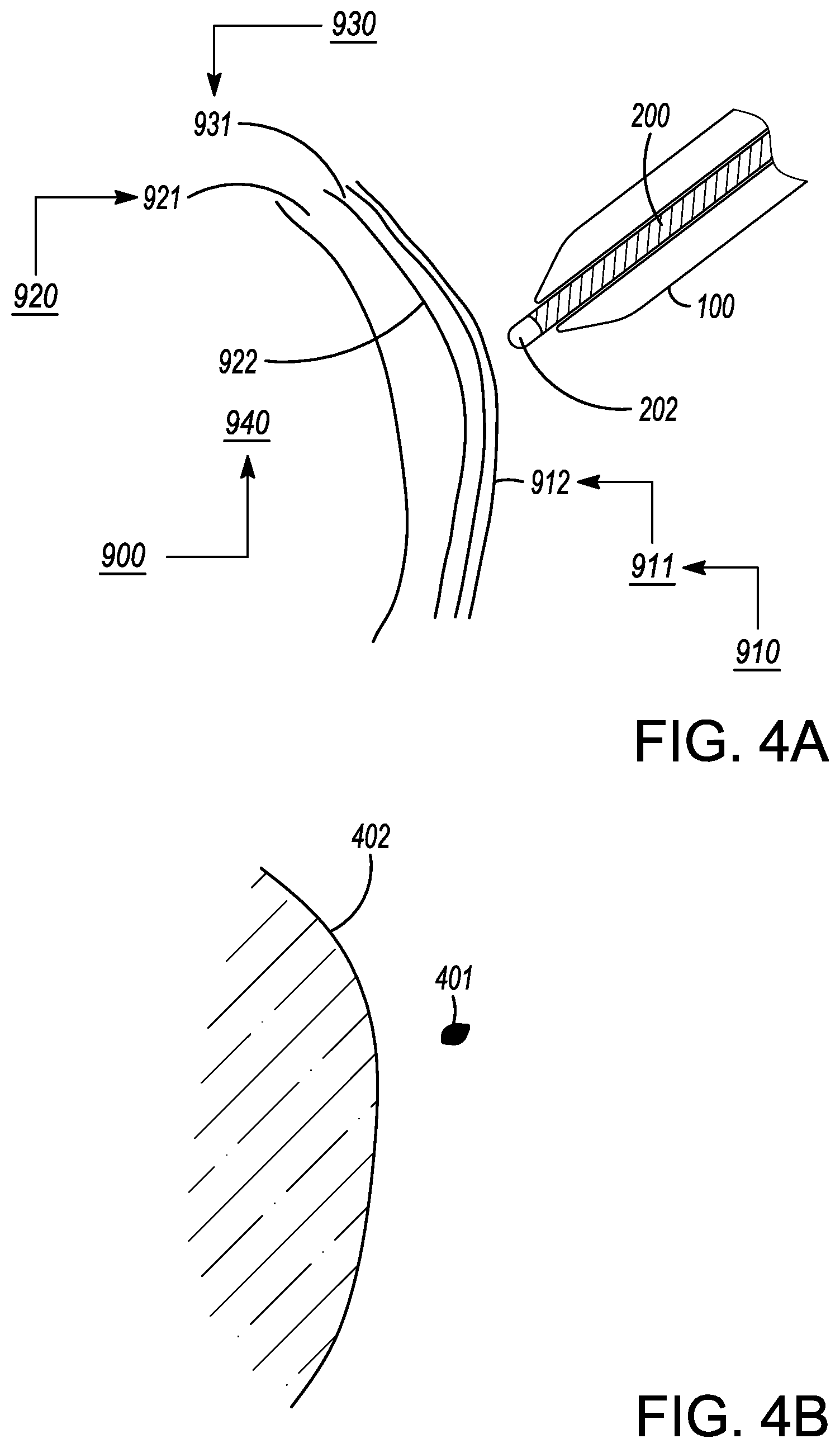 Patent US12599338 Figure 6 – Deflectable elongated guidewire assembly