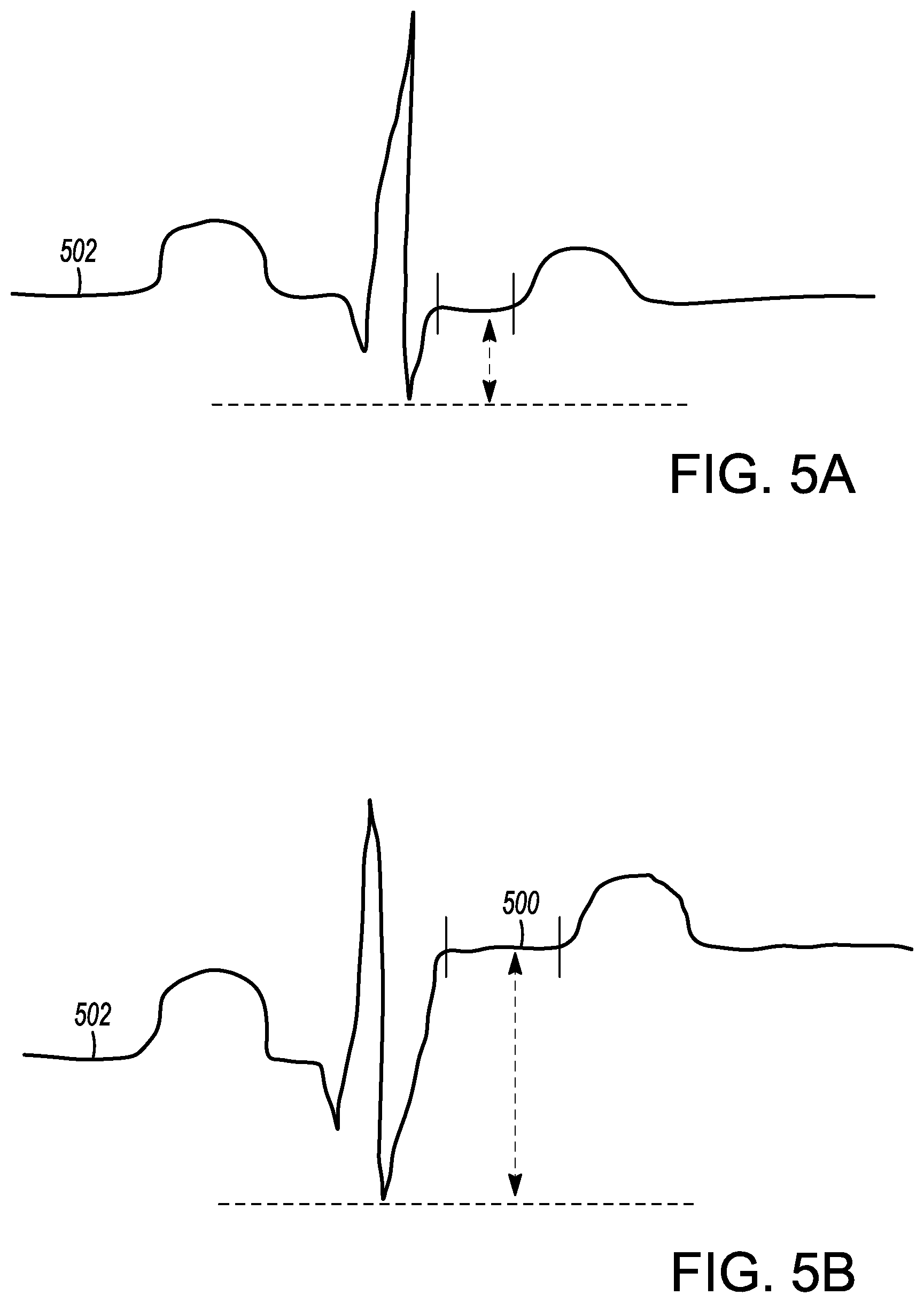 Patent US12599338 Figure 7 – Deflectable elongated guidewire assembly