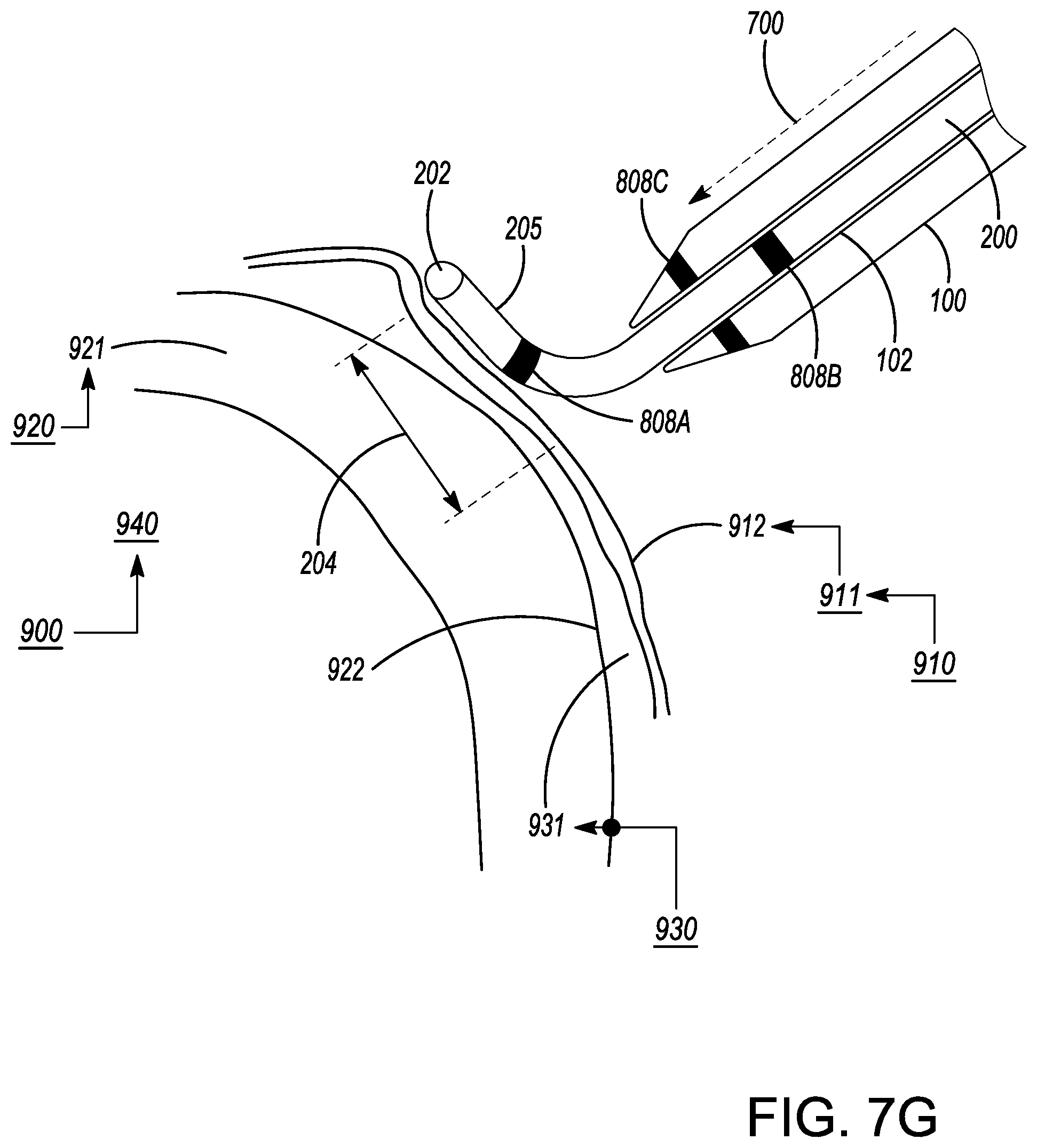 Patent US12599338 Figure 11 – Deflectable elongated guidewire assembly