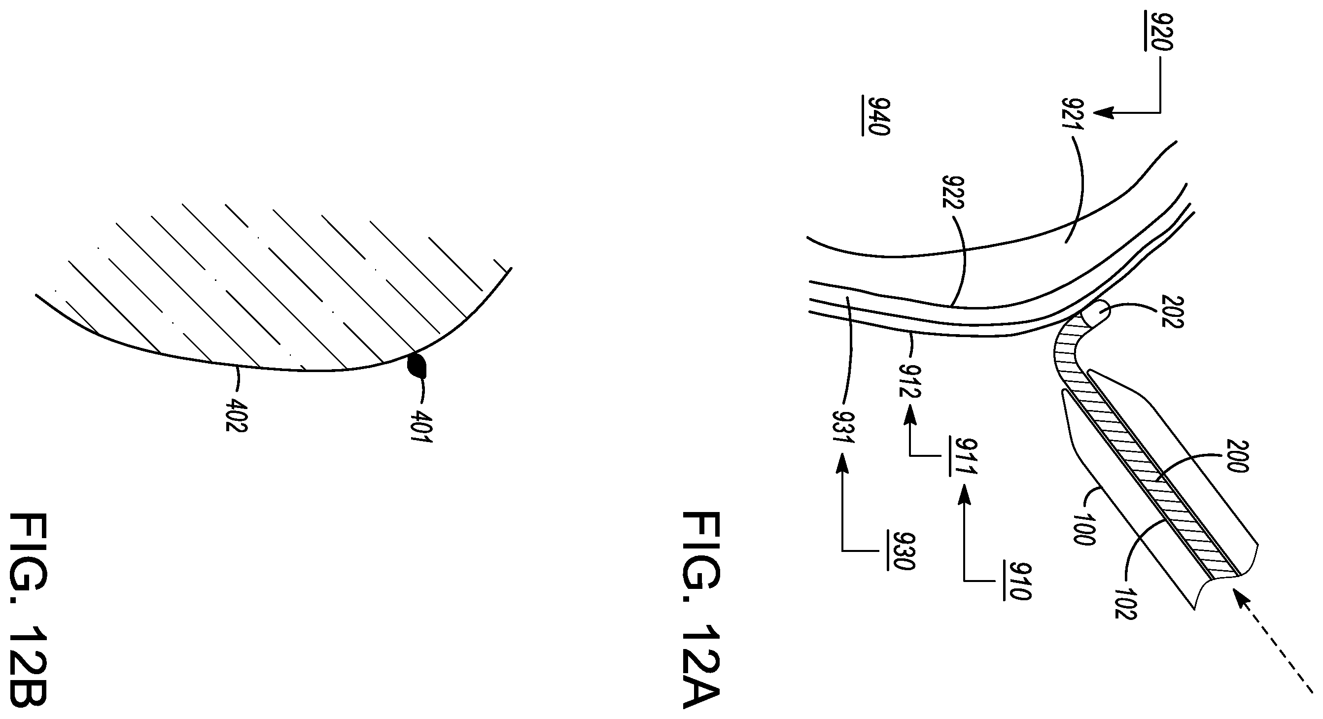 Patent US12599338 Figure 15 – Deflectable elongated guidewire assembly