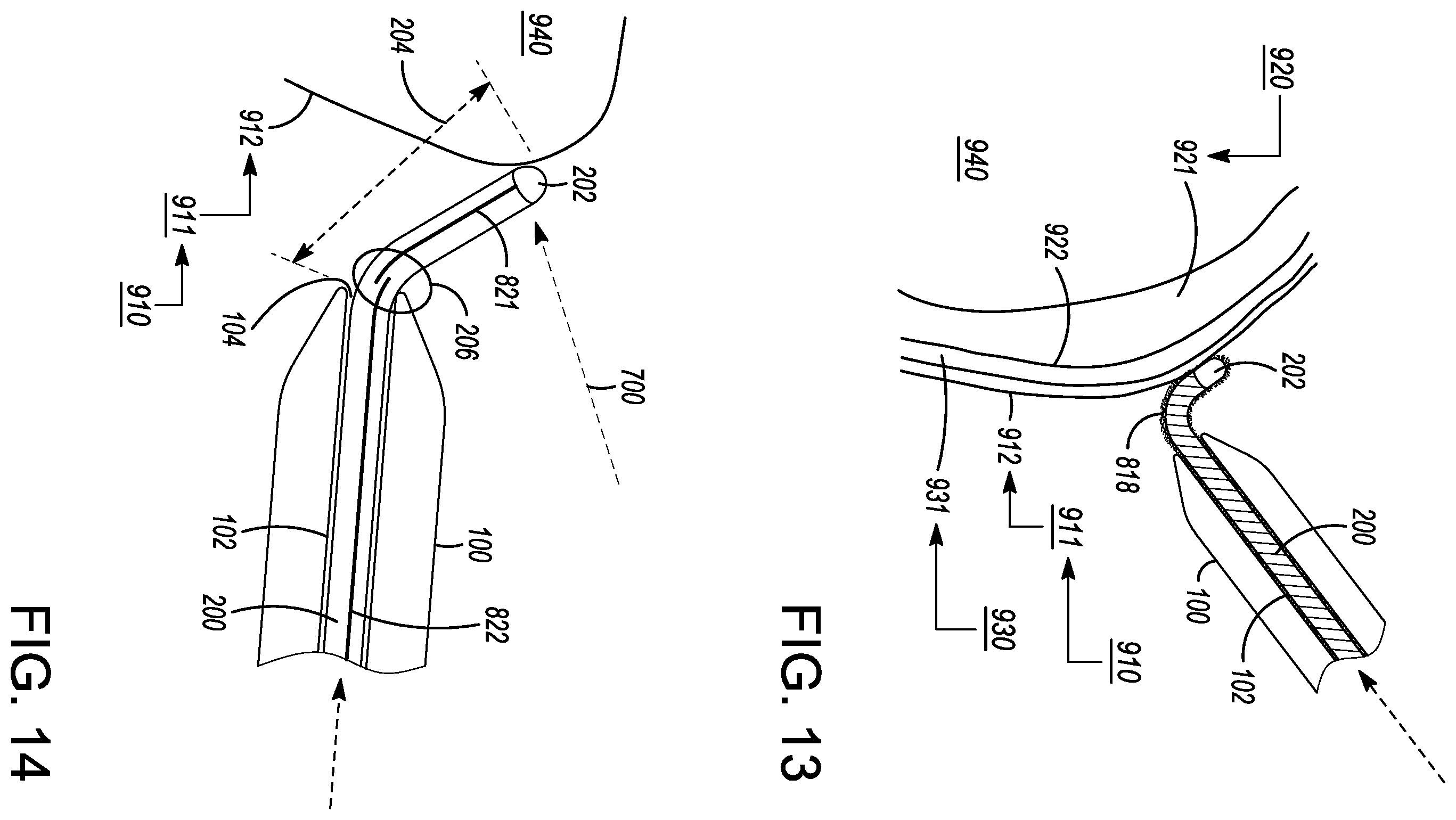Patent US12599338 Figure 16 – Deflectable elongated guidewire assembly