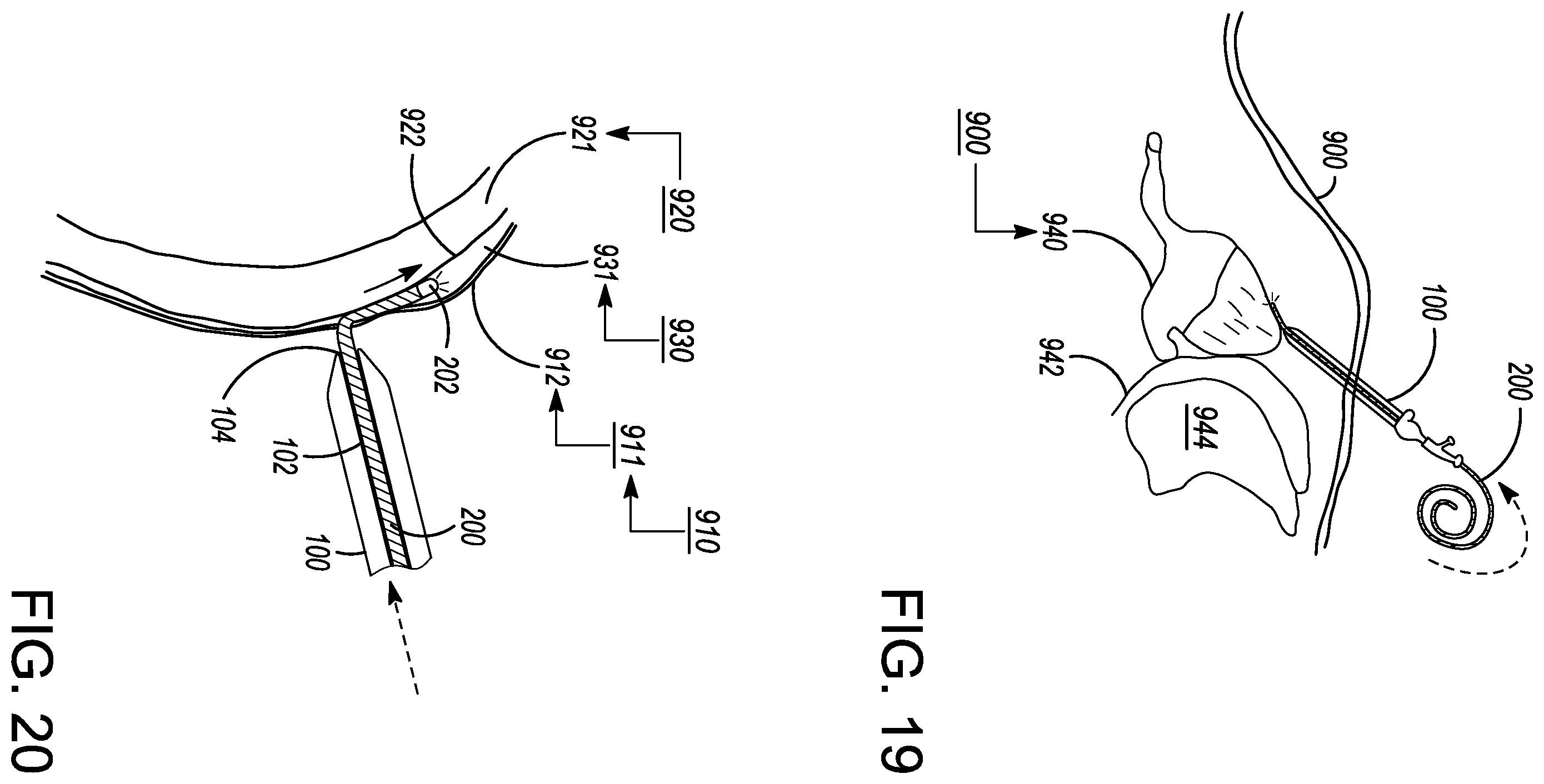 Patent US12599338 Figure 19 – Deflectable elongated guidewire assembly