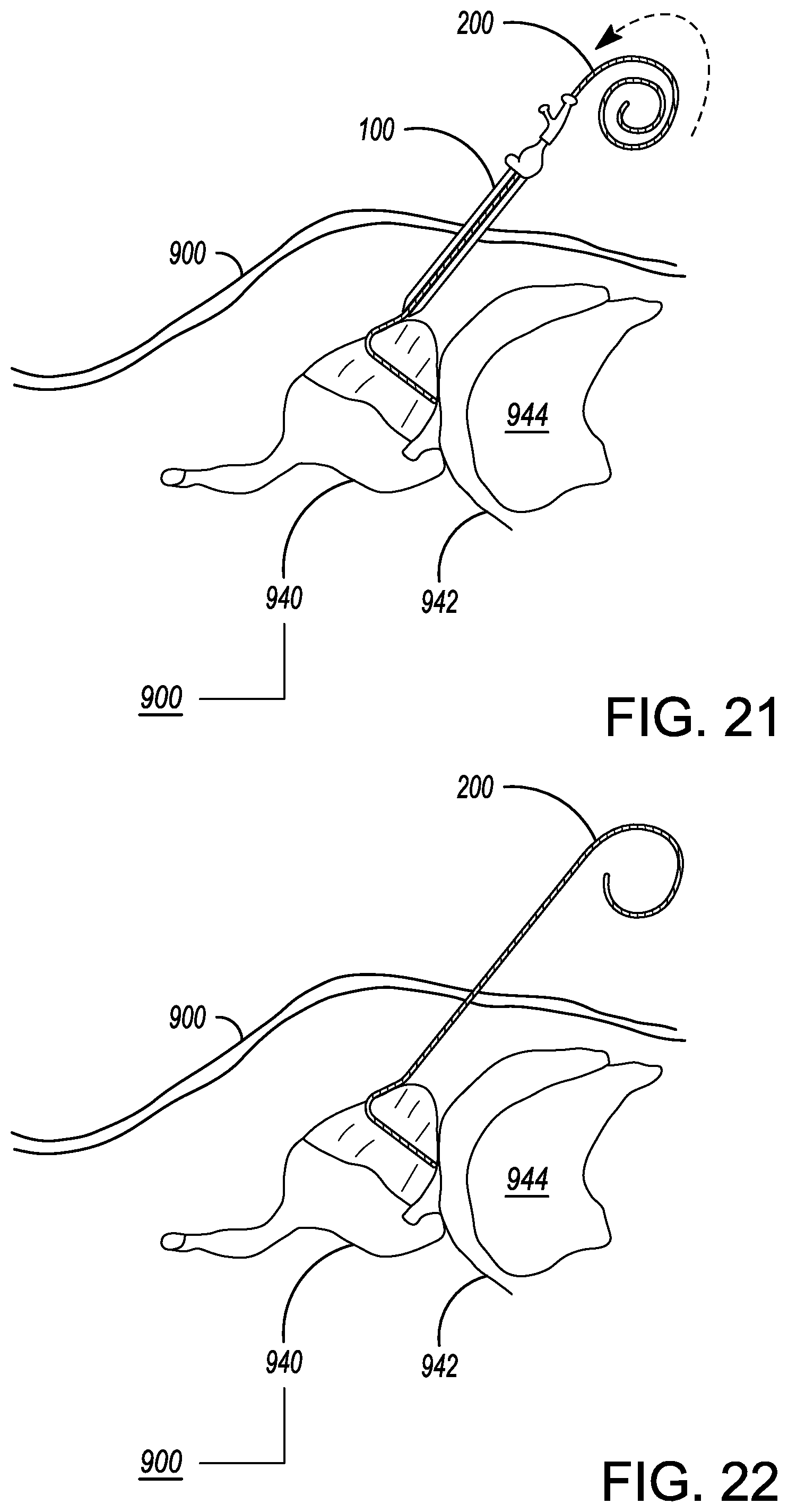 Patent US12599338 Figure 20 – Deflectable elongated guidewire assembly