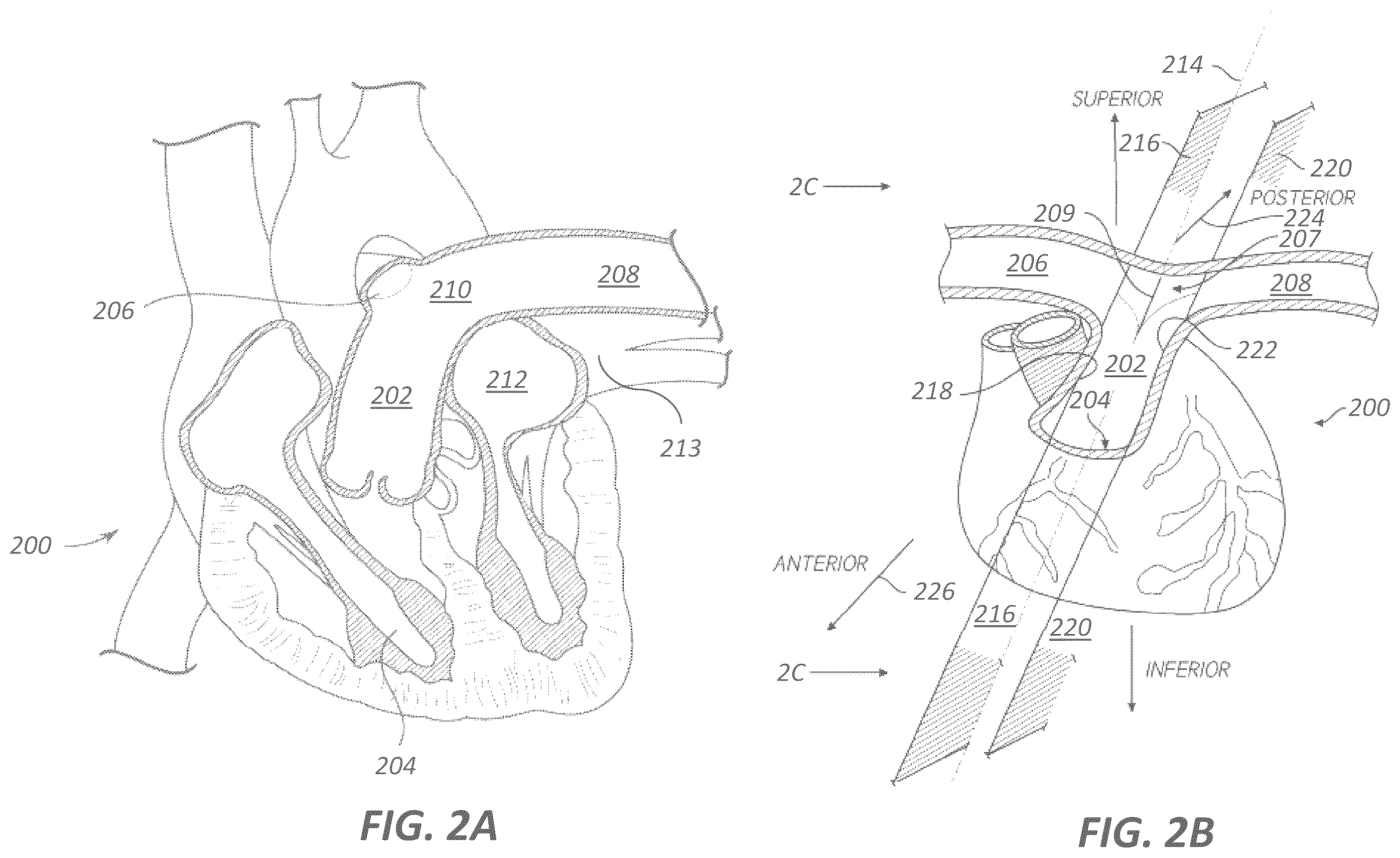Patent US12599339 Figure 2 – Systems and methods for affecting cardiac contractility and/or relaxation