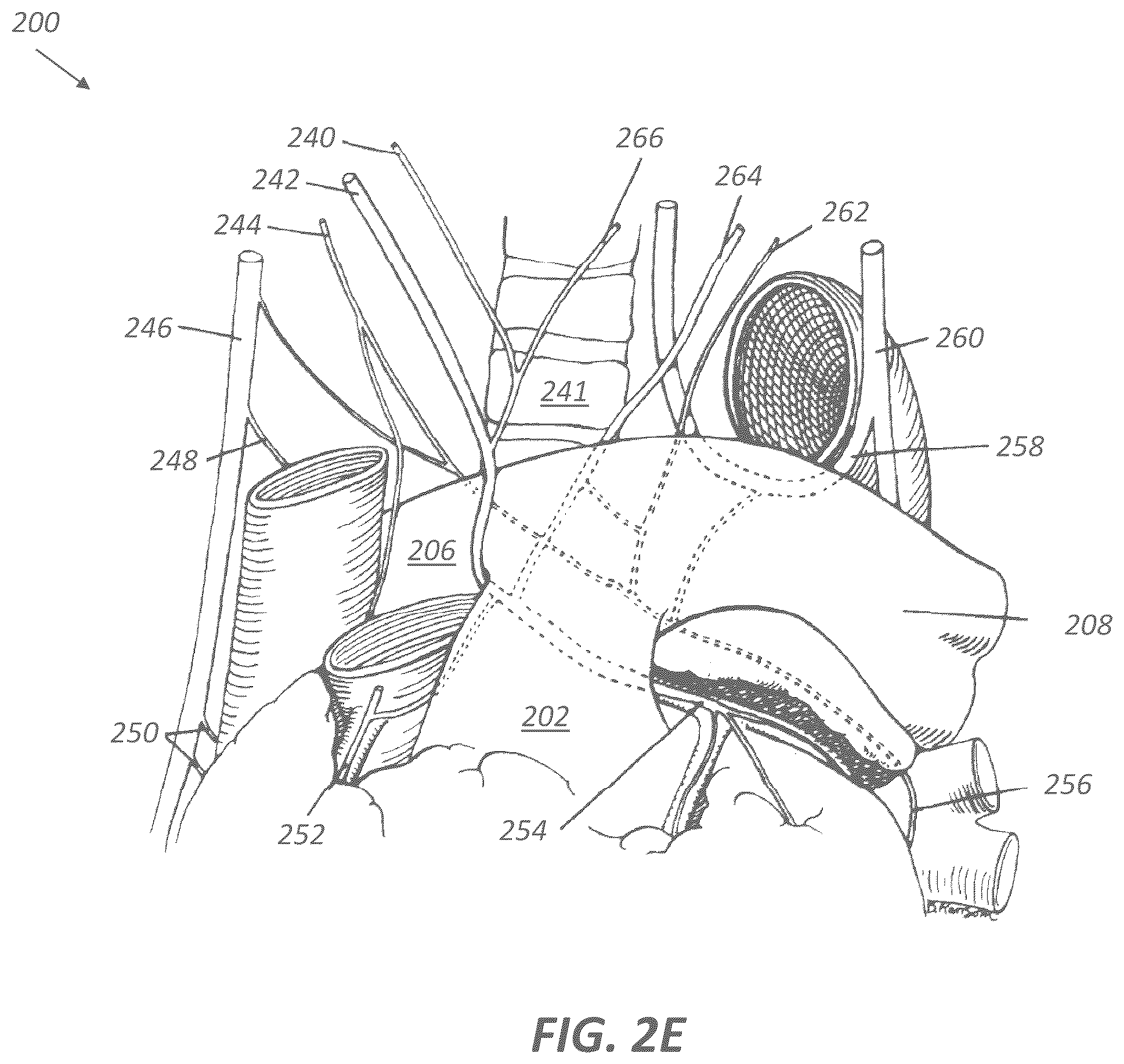 Patent US12599339 Figure 4 – Systems and methods for affecting cardiac contractility and/or relaxation