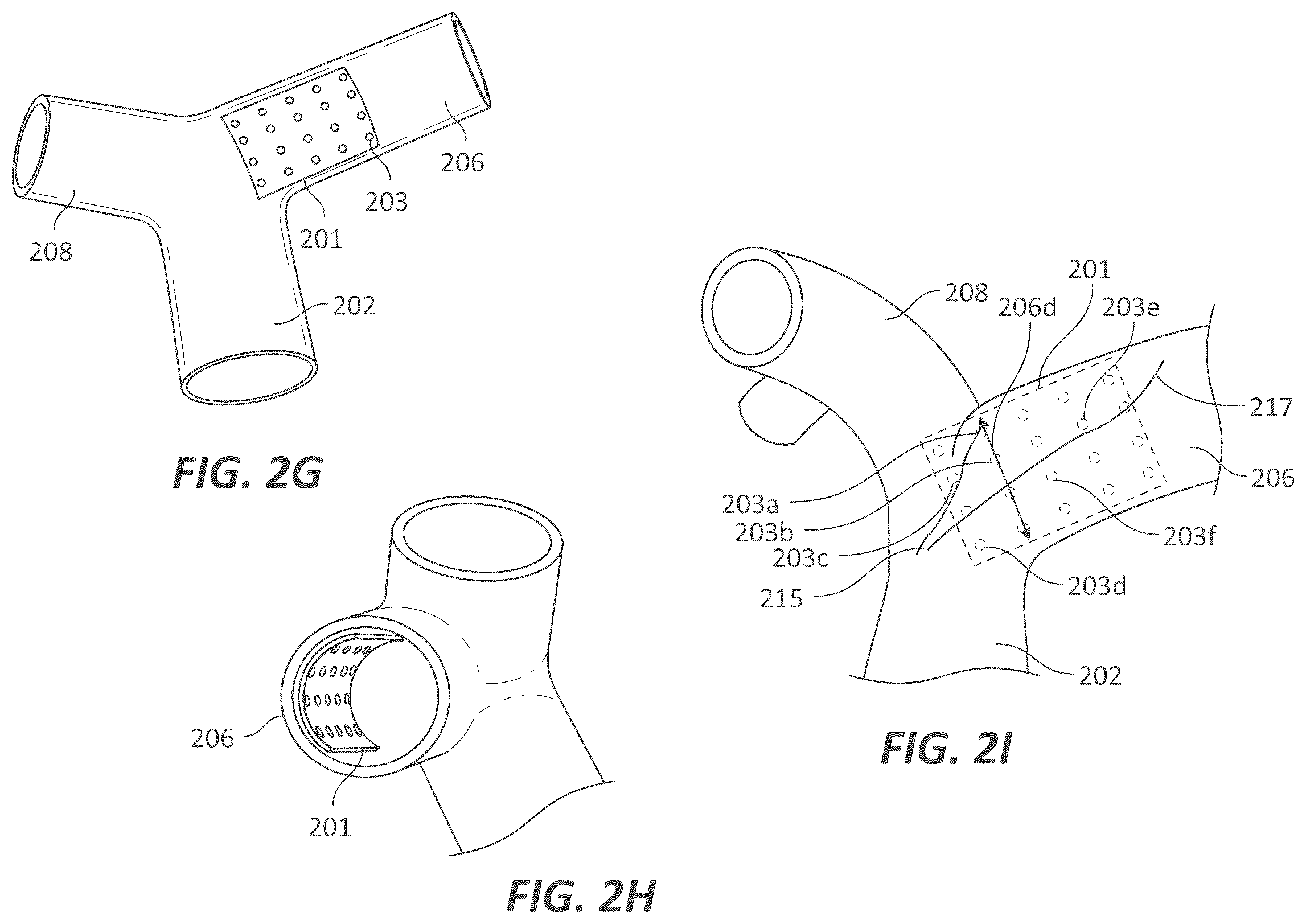 Patent US12599339 Figure 6 – Systems and methods for affecting cardiac contractility and/or relaxation