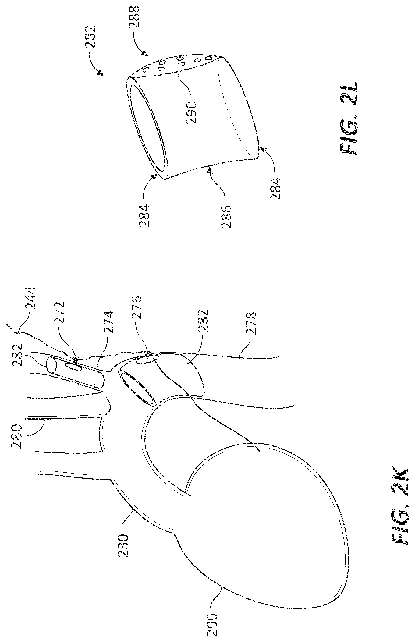 Patent US12599339 Figure 8 – Systems and methods for affecting cardiac contractility and/or relaxation