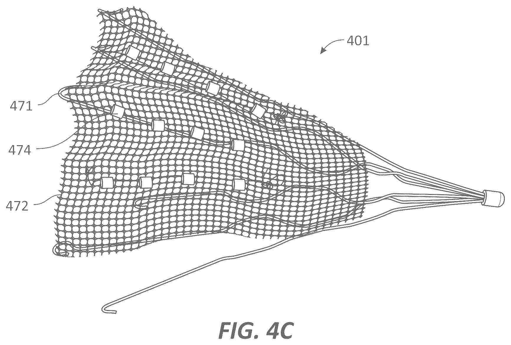Patent US12599339 Figure 11 – Systems and methods for affecting cardiac contractility and/or relaxation