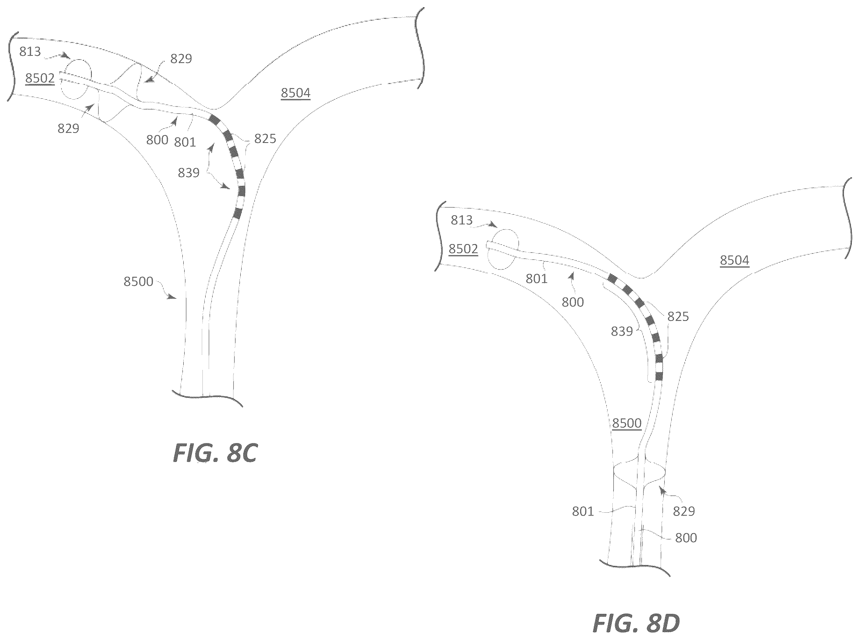 Patent US12599339 Figure 16 – Systems and methods for affecting cardiac contractility and/or relaxation