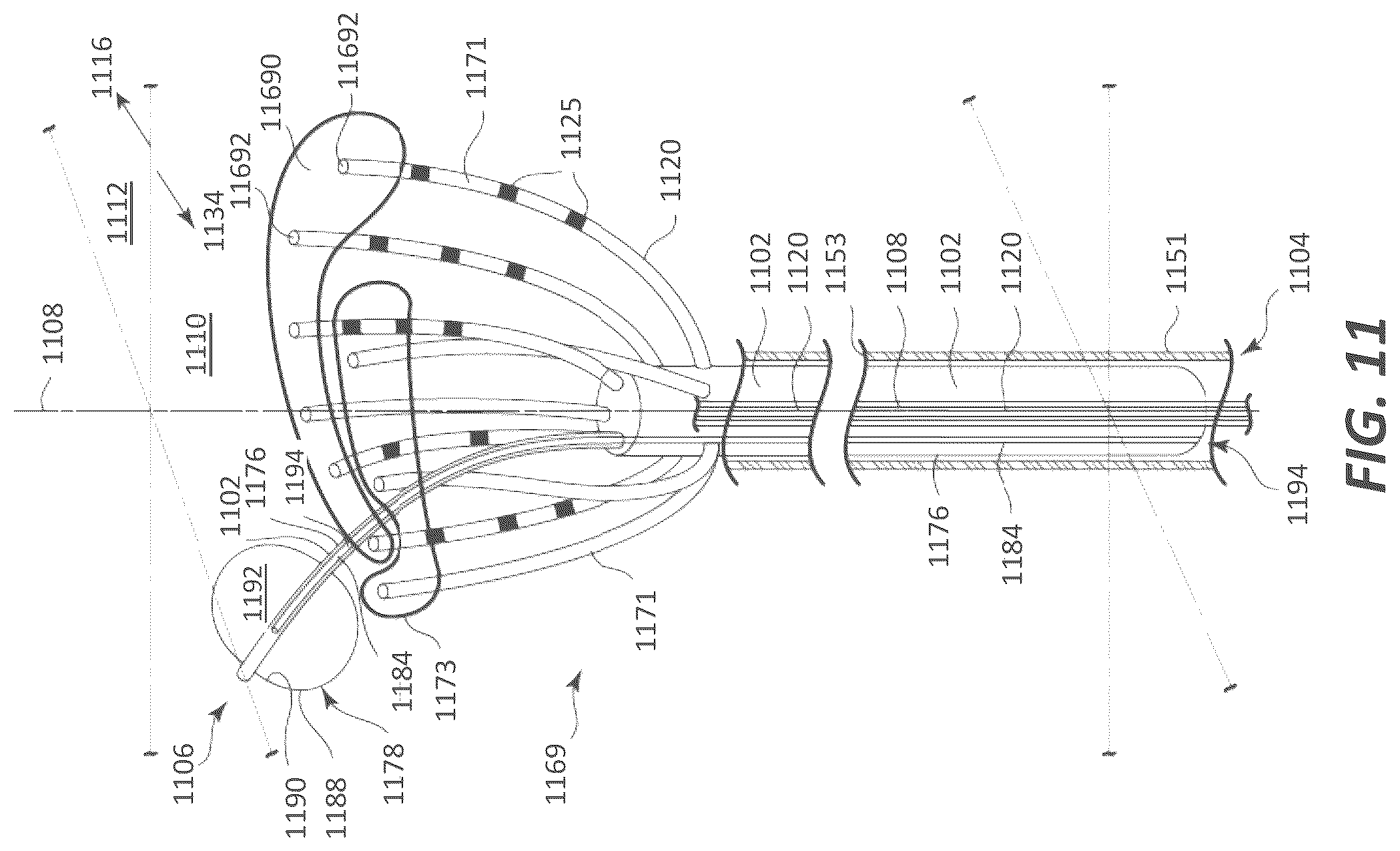 Patent US12599339 Figure 18 – Systems and methods for affecting cardiac contractility and/or relaxation